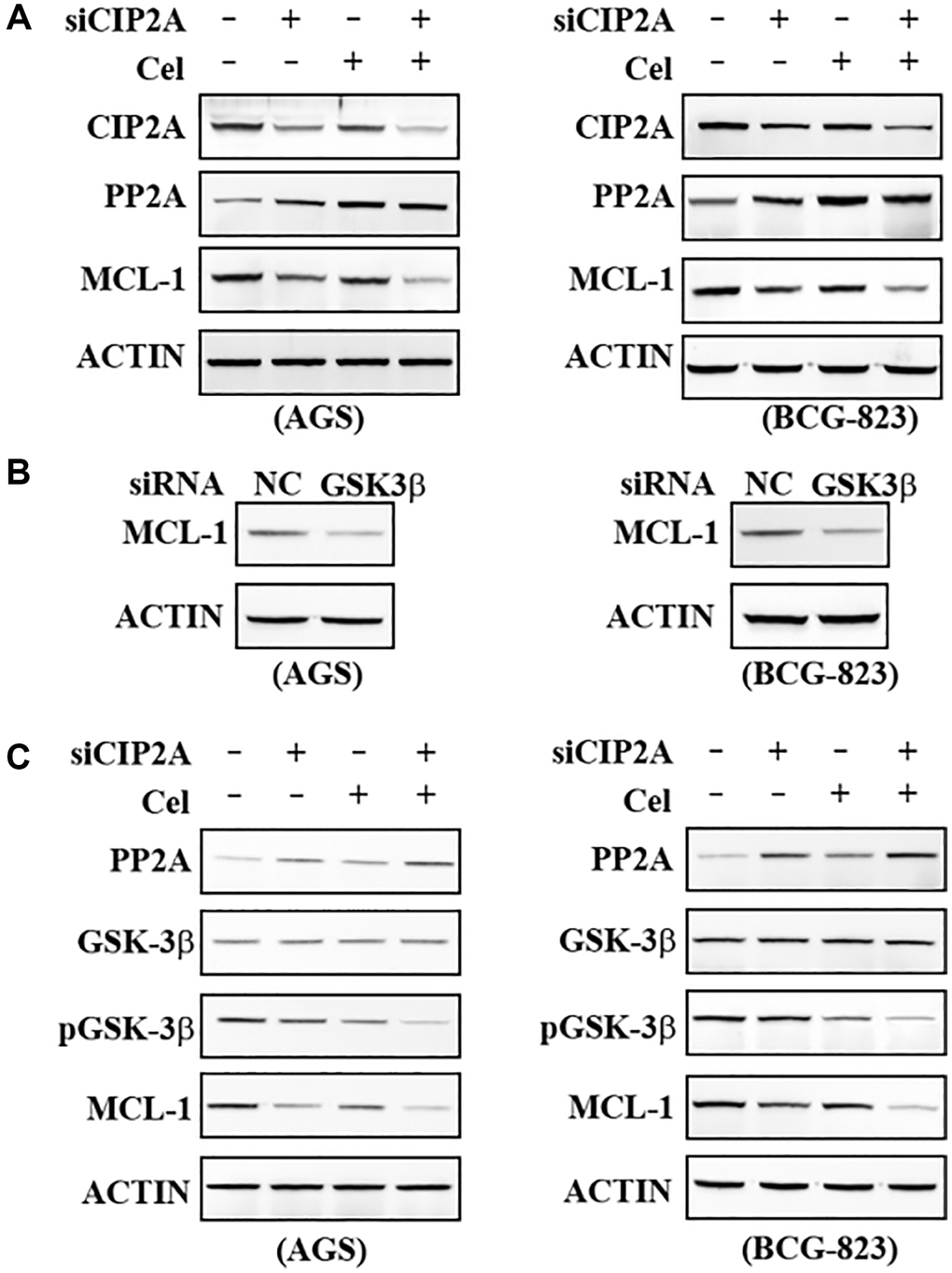 Dephosphorylation by GSK3β enhanced MCL-1 reduction. (A) AGS and BCG-823 cells were transfected with siNC or siCIP2A for 48 h followed by celastrol (5 μM) for 6 h, lysed, and the lysates were probed with indicated antibodies. (B) AGS and BCG-823 cells were transfected with siNC or siGSK3β for 48 h, lysed, and the lysates was probed with anti-MCL-1 antibody. (C) AGS and BCG-823 cells were transfected with siNC or siCIP2A for 48 h, followed by celastrol (5 μM) for 6 h, lysed, the expression of PP2A, GSK-3β, pGSK-3β and MCL-1 were detected by Western blot assay.