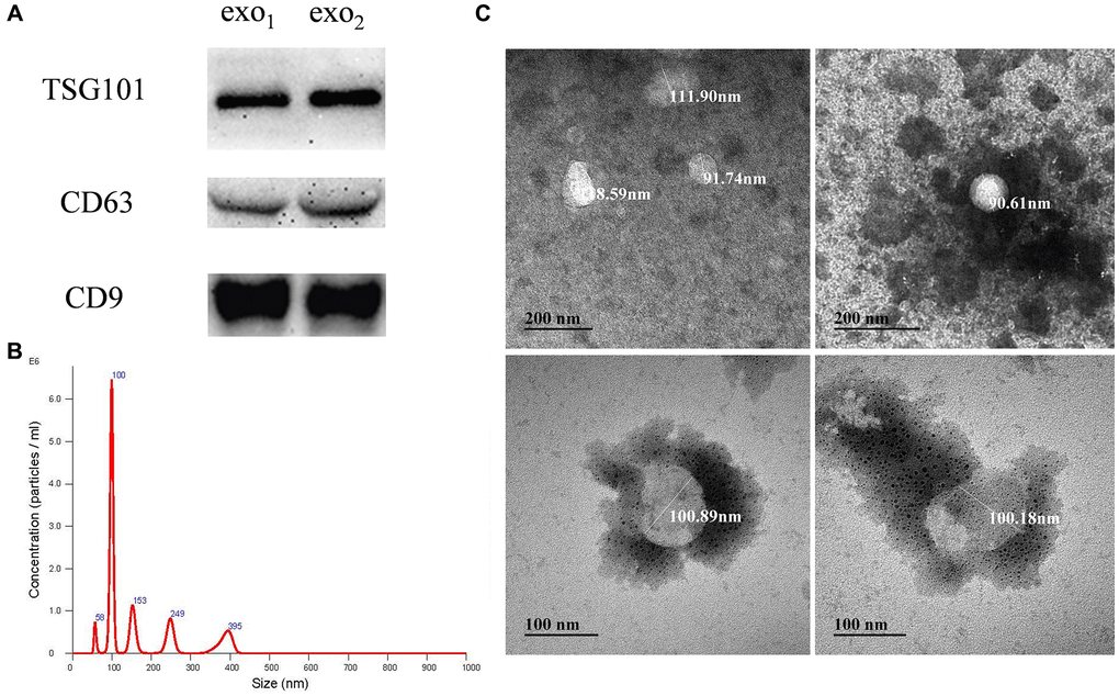 Isolation and identification of human amniotic fluid stem cell exosomes. (A) Expression levels of the exosomal signature expression proteins: TSG101, CD63 and CD9. exo1 and exo2 represent exosomes extracted from two parallel experiments; (B) Distribution of exosomal NTA particle size; (C) Morphology of the exosomes under transmission electron microscopy.