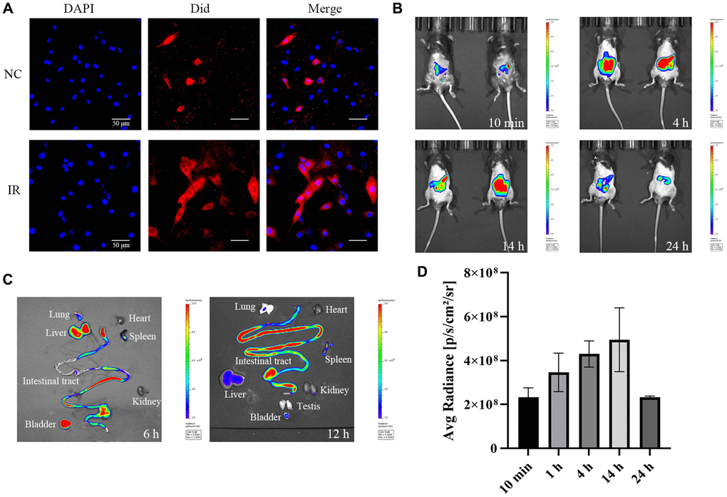 Cellular uptake of exosomes in vitro and metabolism of exosome in vivo. (A) Uptake of exosomes by HEIC-6 cells and intraperitoneal metabolism of exo-ICG. (B) Fluorescence values of the abdomen of mice injected intraperitoneally with exo-ICG at 10 min, 4 h, 14 h and 24 h. (C) Fluorescence values of the abdominal organs of mice at 6 h and 12 h. (D) Fluorescence quantification values.