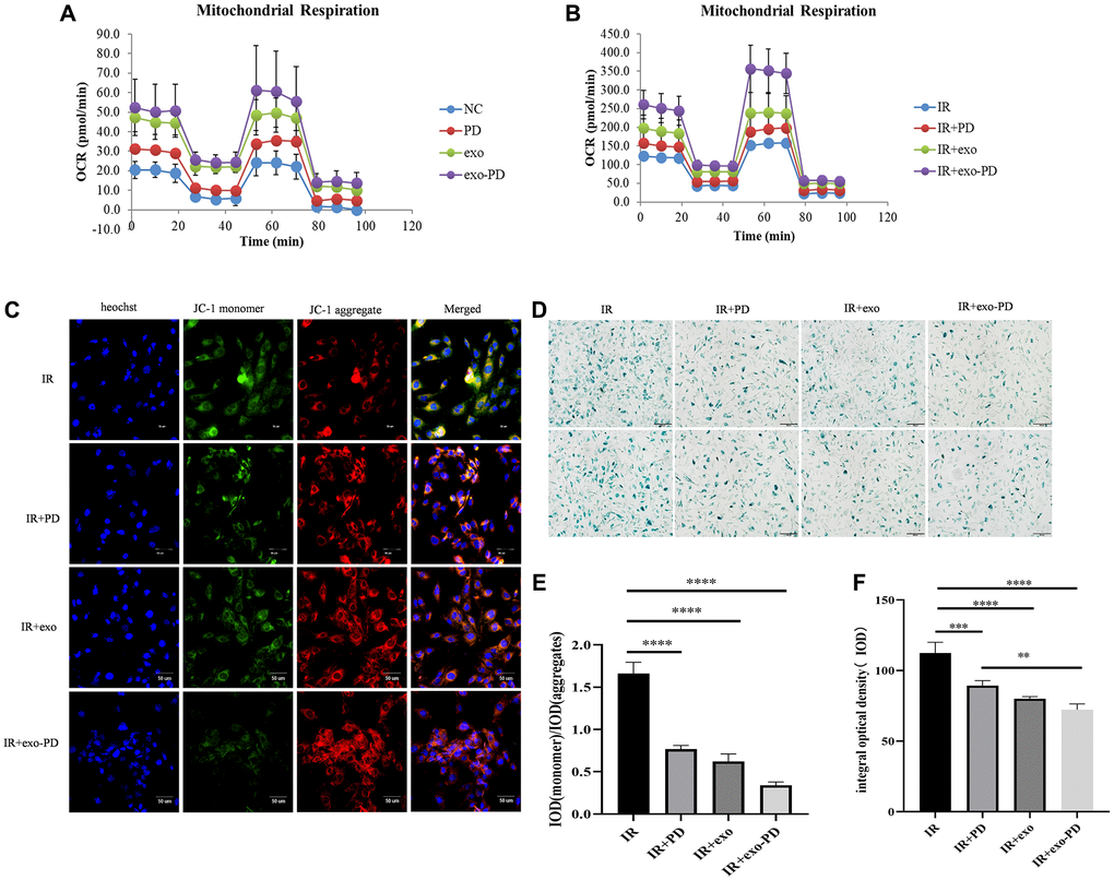 exo-PD regulates mitochondrial oxidative phosphorylation pressure, mitochondrial membrane potential and cellular senescence state in intestinal epithelial cells. (A) Mitochondrial oxidative respiratory pressure test. (B) Oxidative respiratory pressure of HIEC-6 after 8 Gy irradiation and 24 h incubation with the addition of PBS, PD solution, exosome solution and exo-PD solution. (C) exo-PD ameliorates the decrease in mitochondrial membrane potential of intestinal epithelial cells. (D) exo-PD retarded the senescence of intestinal epithelial cells. (E) The ratio of IOD between monomer and aggregates about mitochondrial membrane potential. (F) The IOD of β-galactosidase staining of intestinal epithelial cells in IR group, IR+PD group and IR+exo-PD group. * represents p ** represents p *** represents p **** is p 