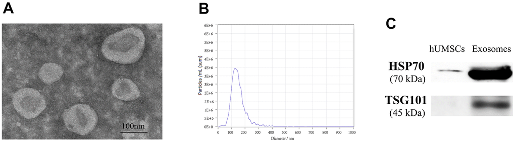 Identification of hUMSC-Exos. (A) The electron microscopy was used for observing the structure of exosomes. (B) The average particle size of exosomes was analyzed through NTA. (C) HSP70 and TSG101 proteins were detected by WB.