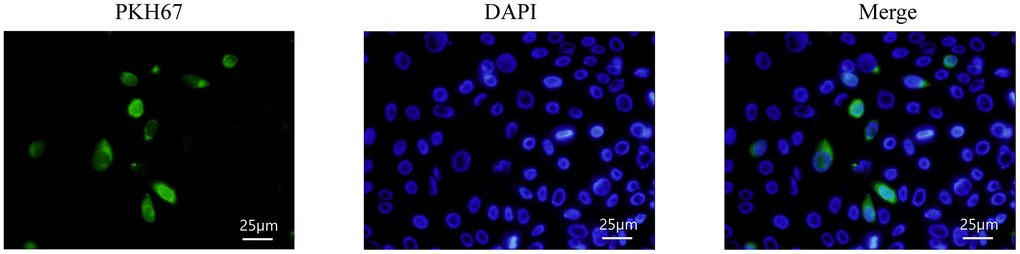 HMrSV5 uptake hUMSC-Exos. Exosomes labeled with PKH67 fluorescence were enriched in the cytoplasm of HMrSV5 under an inverted microscope.