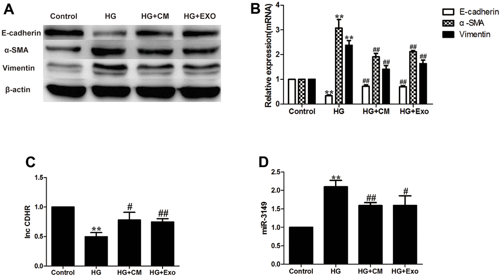 hUMSC-CM improves HG-induced peritoneal EMT via exosomes. (A, B) Expression of EMT markers (α-SMA, Vimentin, and E-cadherin) in HMrSV5 was detected by WB and PCR after hUMSC-CM and hUMSC-Exos treated HMrSV5 which was stimulated by HG. (C, D) The expression of miR-3149 and lnc-CDHR was detected by PCR. Each value represents the mean ± SEM (n=3) (**P##P#P