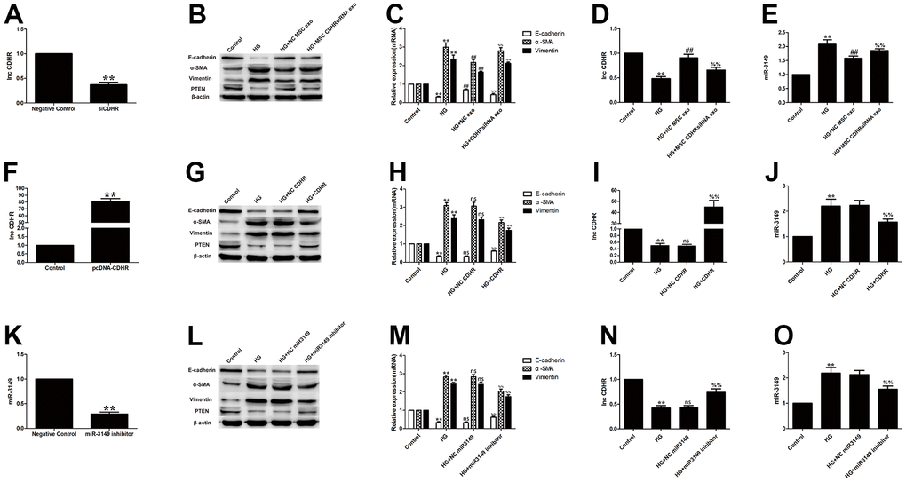 Exosomal lnc-CDHR of hUMSCs alleviates HG-induced EMT by down-regulating miR-3149 and up-regulating PTEN. (A) Transfection efficiency of exosomal lnc-CDHR extracted from transfected stem cells was detected by PCR. (B, C) The effect of MSC CDHR siRNA exosomes on the expression of EMT and PTEN in HG-induced HMrSV5 was detected by WB and PCR. (D, E) Lnc-CDHR and miR-3149 expression were detected by PCR after treatment of HG-induced HMrSV5 with MSC CDHR siRNA exosomes. (F) Transfection efficiency of pc-DNA CDHR was detected by PCR. (G–J) Expressions of Vimentin, α-SMA, E-cadherin, PTEN, CDHR, and miR-3149 were detected by WB and PCR after transfection of pc-DNA CDHR in HG-induced HMrSV5. (K) Transfection efficiency of miR-3149 inhibitor was detected by PCR. (L–O) To illustrate the effect of miR-3149 on EMT, changes of EMT, PTEN, CDHR, and miR-3149 were detected by WB and PCR after miR-3149 inhibition. Each value represents the mean ± SEM (n=3) (**P##Pns no significance vs. HG, (C–E) %%PH–J) %%PM–O) %%P