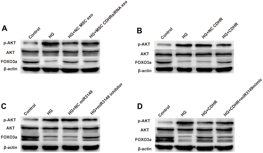 hUMSC-Exos attenuated peritoneal EMT through regulation of the AKT/FOXO signaling pathway. (A) Exosomes from hUMSCs could suppress AKT/FOXO signaling pathway in HG HPMCs by WB. (B–D) Exosomal lnc-CDHR from hUMSCs adsorbed miR-3149 to alleviate EMT through the AKT/FOXO signaling pathway.