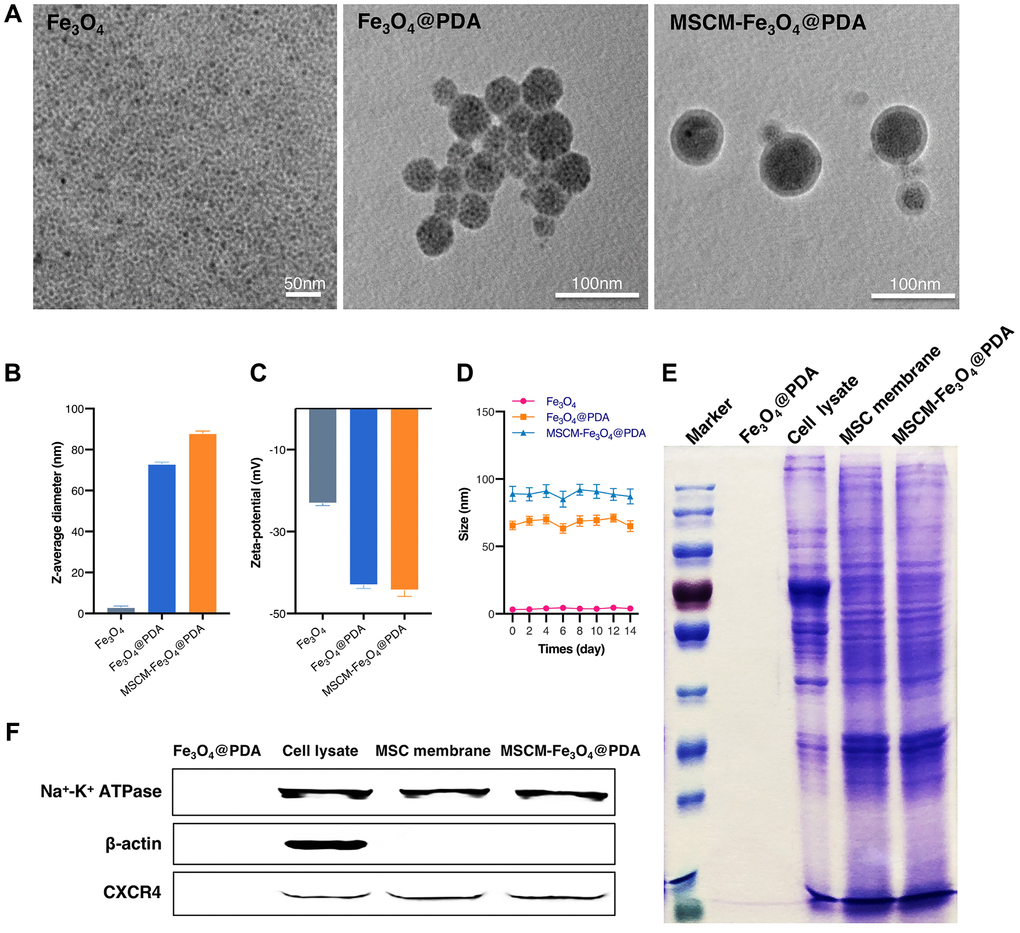 Characterization of Fe3O4, Fe3O4@PDA and MSCM-Fe3O4@PDA NPs. (A) TEM images of NPs. (B) DLS of NPs. (C) Zeta potential of NPs. (D) Stability analysis of NPs. (E) SDS-PAGE protein analysis of Fe3O4@PDA, Cell lysate, MSC membrane and MSCM-Fe3O4@PDA. (F) Membrane protein expressions of Fe3O4@PDA, Cell lysate, MSC membrane and MSCM-Fe3O4@PDA.