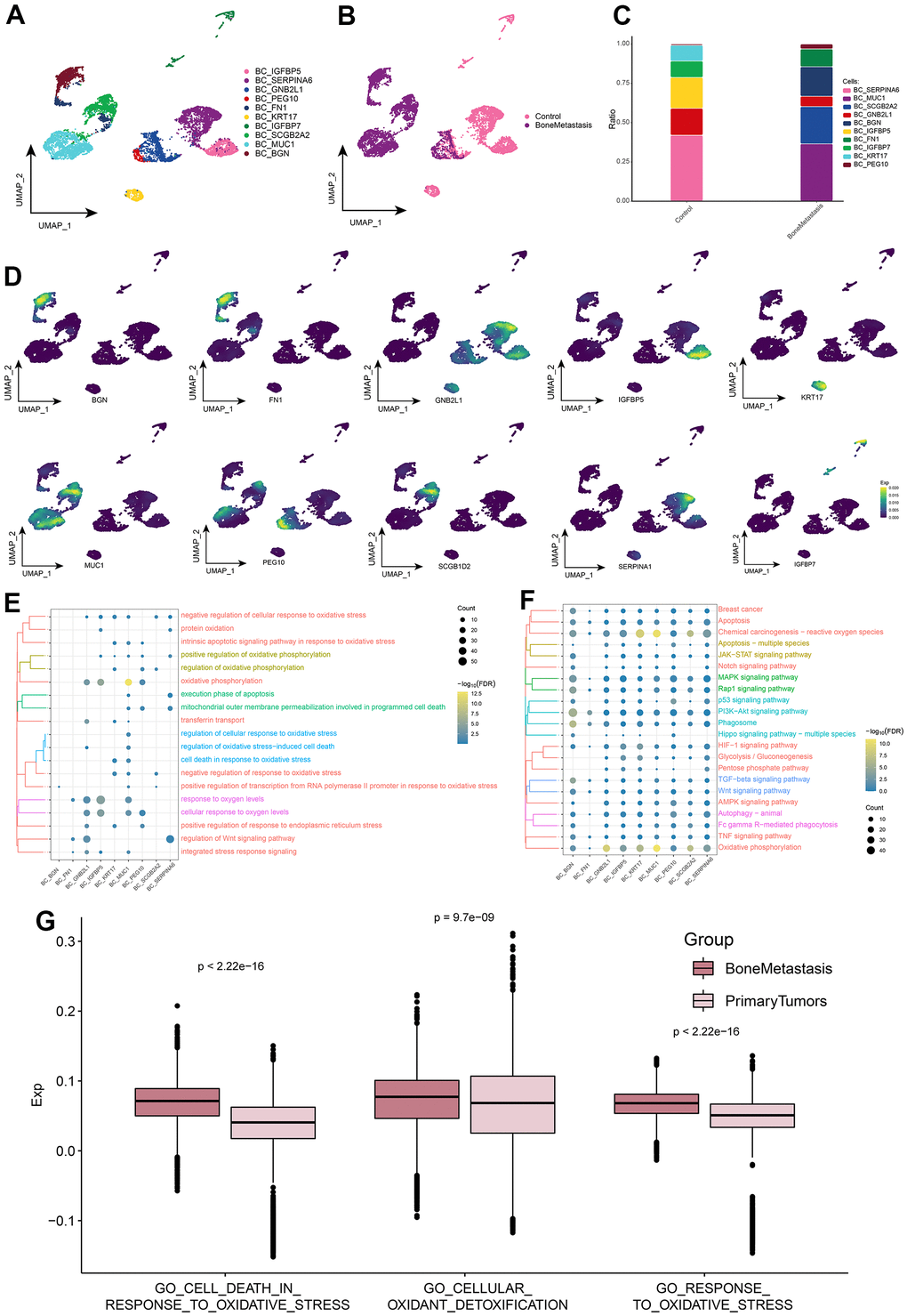 Breast cancer cell subpopulations in patients with bone metastases from breast cancer. (A) Single-cell atlas showing breast cancer cell subpopulations. (B) Single-cell atlas showing breast cancer cell subpopulations in control and breast cancer bone metastasis patients. (C) Differential abundance of breast cancer cell subpopulations in control and breast cancer bone metastasis patients. (D) Marker genes specifically and highly expressed in subpopulations of breast cancer cells. (E, F) Biological processes (E) and signaling pathways (F) enriched in breast cancer cell subpopulations. (G) Comparison of the differences in oxidative stress levels in breast cancer cells between control and bone metastasis samples.