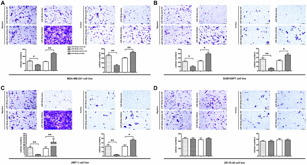 Migration and invasion ability of MDA-MB-231, SUM159PT, JIMT-1, but not ZR-75-30 cells in each group. (A–D) Migration was used to detect the number of MDA-MB-231 cells passing through the lower compartment (×400); Invasion was performed to detected the number of mDA-MB-231 cells that crossed the basement membrane (×400). *P **P 