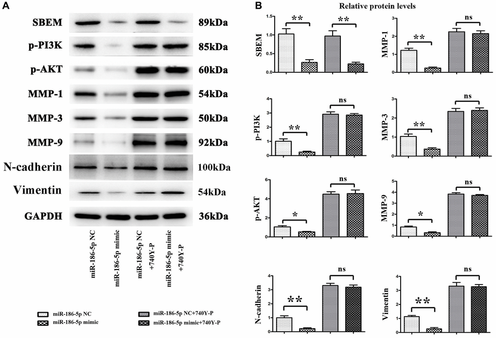 Protein expression changes of SBEM, P-PI3K, p-Akt, T-P38, MMP1, MMP3 and MMP9, vimentin, N-cadherin in MDA-MB-231 cells in each group. (A) Protein bands for SBEM, P-PI3K, p-Akt, T-P38, MMP1, MMP3 and MMP9, vimentin, N-cadherin; (B) Statistics on relative protein expression levels of SBEM, P-PI3K, p-Akt, T-P38, MMP1, MMP3 and MMP9, vimentin, N-cadherin. *P **P 
