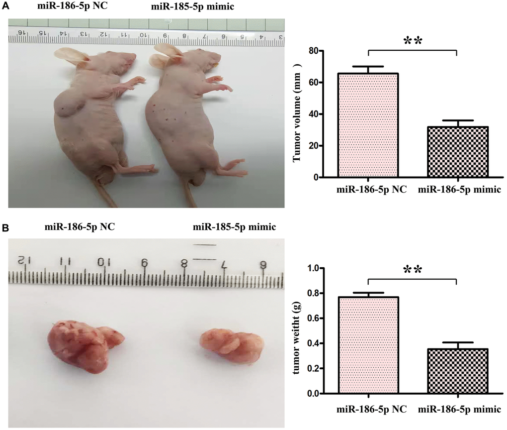 miR-186-5p suppressed the progression of tumor in nude mice. (A) Changes of tumor volumes in nude mice in miR-186-5p NC group and mimic group; (B) Changed of tumor weight in miR-186-5p NC group and mimic group; *P **P 