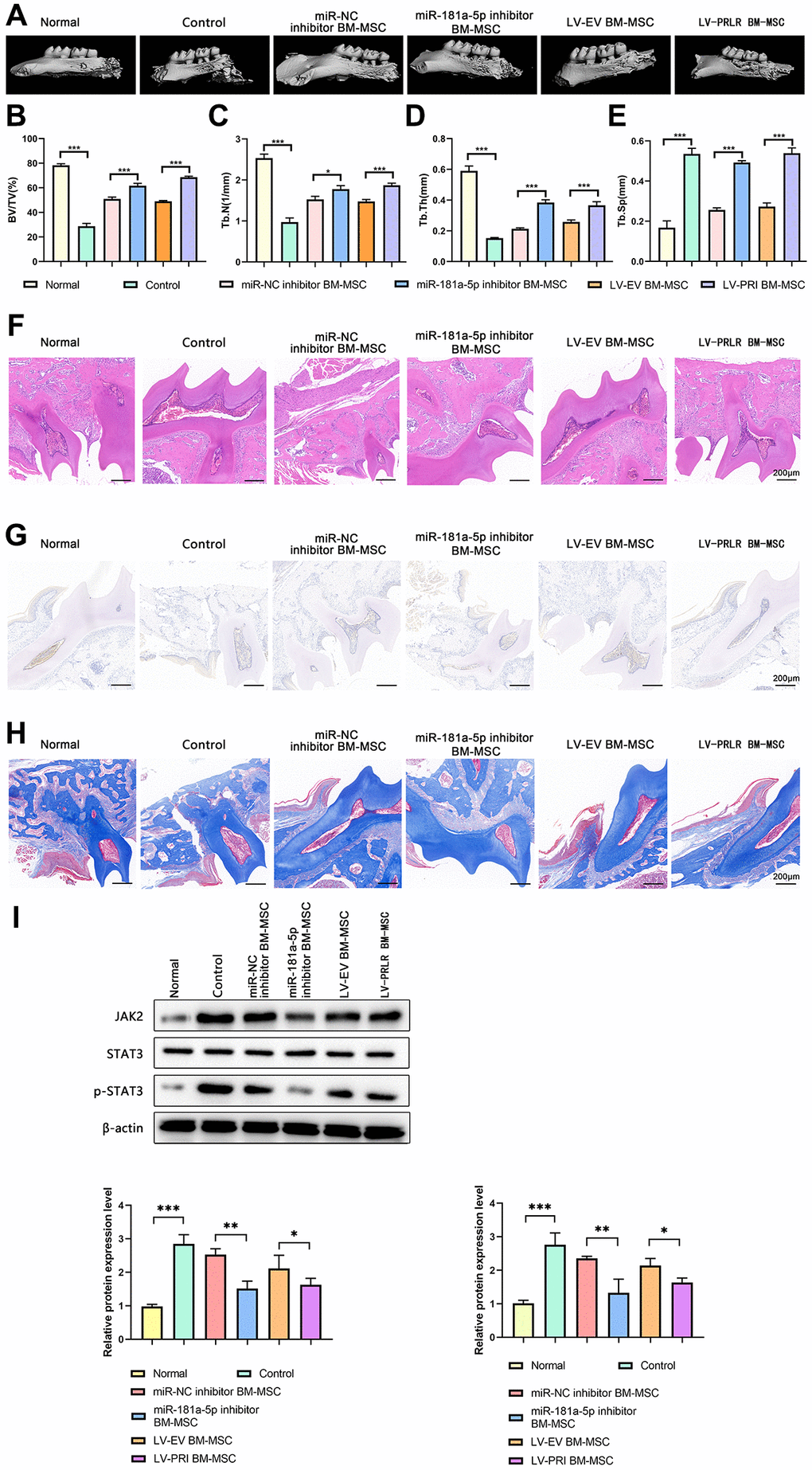 Targeted manipulation of the LncRNA SPIRE1/miR-181a-5p/PRLR pathway in BM-MSCs enhanced their immunomodulation in mice with periodontitis. (A–I) After disease induction, mice were left un-treated, or infused with control mandibular BM-MSCs, or the mandibular BM-MSCs transfected with miR-181a-5p inhibitor, or the mandibular BM-MSC infected with control lentivirus or PRLR-expressing lentivirus as indicated. The up-regulated expression of PRLR after infection of PRLR-expressing lentivirus was confirmed by western blot assays. (A) Micro-CT images show the osteogenesis around the periodontal tissues. (B–E) The BV/TV (%) (B), Tb.N1 (C), Tb.Th (D), and Tb.Sp (E) in mice of the indicated groups were summarized. (F–H) Histological analyses of the periodontal tissues by H&E staining (F), TRAP staining (G), and Masson staining (H) were conducted. The representative images of each group are shown. (I) The protein levels of JAK2 and pSTAT3 in periodontal tissues of the indicated groups were quantitated by western blot assays. n = 5 mice for each group; *P **P ***P 