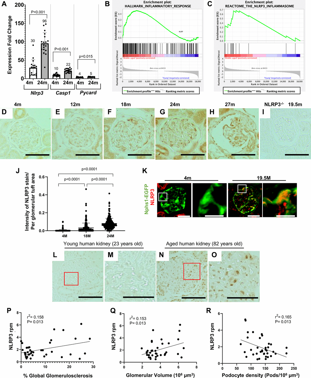 Increase in the NLRP3 inflammasome in middle-aged podocytes. (A) qRT-PCR of inflammasome components Nlrp3, Casp1 and Pycard comparing podocytes from 4 months (m)-old to 24 m-old mice. Graph shows increase in the NLRP3 signaling. Error bars correspond to standard deviation; data are compared using Student’s test and p-values are indicated above the bars. (B, C) GSEA plots comparing podocytes isolated from middle-aged to young mice show enrichment of inflammatory response (B) and the NLRP3 inflammasome (C) gene sets. (D–J) Nlrp3 immunoperoxidase staining (brown) comparing glomeruli of differently aged mice with no staining at 4 m (D) and 12 m (E), but increasing staining at 18 m (F), 24 m (G) and 27 m (H). Quantification of the staining intensity is shown in (J). NLRP3 staining was absent in NLRP3 null (−/−) mice aged 19.5 m (I). (K) NLRP3 immunofluorescent staining (red) was absent in podocytes (labeled in green) of young, 4 m-old Nphs1-EGFP reporter mice, but colocalized to podocytes of 24 m-old aged mice (labeled in yellow/orange). (L–O) NLRP3 immunostaining of human kidneys shows no staining in young (23 years old) glomeruli (L, M), but is detected in aged (82 years old) glomeruli (N, O). Panels (M) and (O) show enlarged views indicated by the red boxes in (L) and (N), respectively. (P–R) NLRP3 transcripts from micro-dissected human glomeruli. Higher Expression of NLRP3 is associated with increased percent of globally sclerosed glomeruli (Figure 1P), higher glomerular volume (Figure 1Q) and reduced podocyte density (Figure 1R).