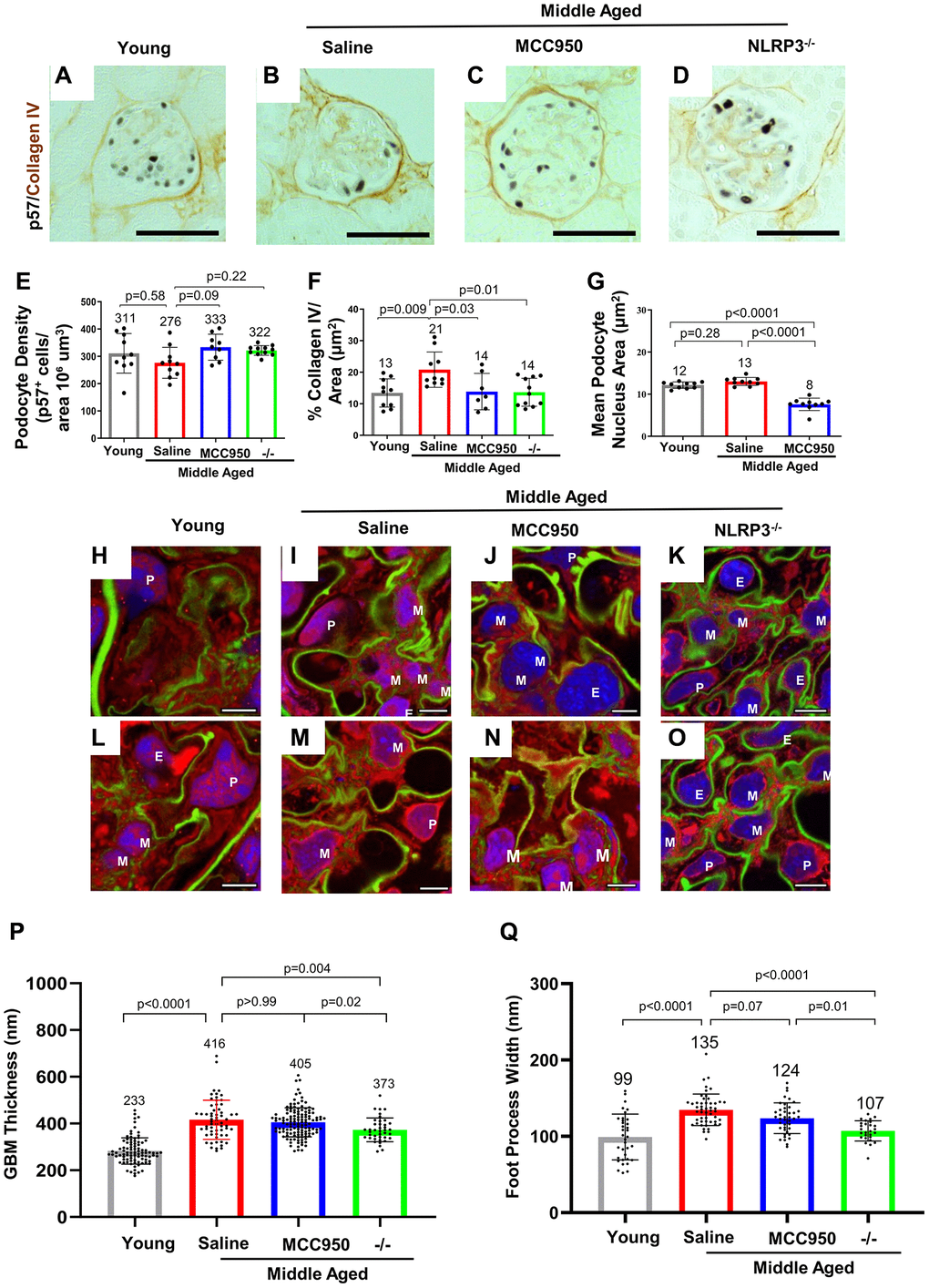 Podocyte lifespan and glomerular ultrastructure were improved by inhibiting and deleting NLRP3. (A–F) Immunostaining for p57 (black, nuclear) and Collagen IV (brown) comparing glomeruli of young, middle-aged saline-treated, MCC950-treated mice as well as NLRP3 null mice. Quantification of the number of p57-positive podocytes was used to determine podocyte density (E), Collagen IV staining to assess glomerular scaring (F) and their nuclear size was used to determine hypertrophy (G). Samples were compared using Student’s t-test and significance is indicated. Representative images are shown; the scale bars in the images correspond to 25 μm. (H–O) Analysis of glomerular ultrastructure using FLARE coupled to confocal microscopy; hydrogel-expanded mouse kidney tissue has been stained for primary amines (red, labels proteins), oxidized carbohydrates (green, labels basement membrane and mesangial matrix), and DNA (blue, labels nuclei). Representative images comparing glomeruli of young, middle-aged saline-treated, MCC950-treated mice as well as NLRP3 null mice are shown. All scale bars correspond to 5 μm pre-expansion. Abbreviations: P: podocyte; E: endothelial cells; M: mesangial cells. (P, Q) Quantification of glomerular basement membrane (GBM) thickness by measuring the average thickness of the oxidized carbohydrate stain in capillary loops (P) and of foot process width by determining the average thickness of the amine-stained foot processes at half-maximum (Q).