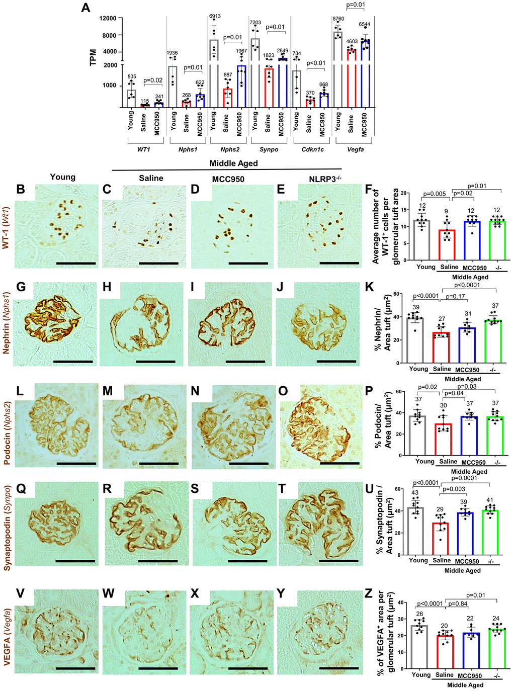 Podocyte health was improved upon inhibition/absence of NLRP3. (A) Comparison of the transcripts for canonical podocyte genes (Wt1, Nphs1, Nphs2, Synpo, Cdkn1c, Vegfa) using the normalized mRNA-seq read counts from isolated podocytes of middle-aged saline-treated (red bars) and MCC950-treated mice (blue bars) compared to their young counterparts (grey bars). (B–Z) Immunostaining of kidneys from young, saline- and MCC95-treated middle-aged as well as middle-aged Nlrp3 null mice for WT-1/Wt1 (B–F), Nephrin/Nphs1 (G–K), Podocyin/Nphs2 (L–P), Synaptopodin/Synpo (Q–U) and VEGFA (V–Z). Representative images are shown; scale bars represent 25 μm. Staining intensities were quantified and depicted in the graphs as % tuft area.