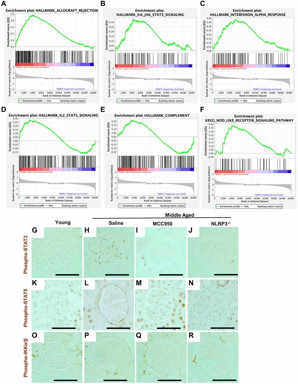 Podocyte inflammaging is reduced by inhibiting NLRP3. (A–F) GSEA plots comparing the transcriptomic data from saline- and MCC950-treaded middle-aged mice for 5 hallmark gene sets (allograft rejection, IL-6/JAK/STAT3 signaling, interferon alpha response, IL-2/STAT5 signaling and complement) as well as one KEGG gene set (Nod-like receptor signaling pathway). (G–R) Immunoperoxidase staining comparing glomeruli from young mice, to middle-aged either treated with saline or MCC950 as well as middle-aged NLRP3 null mice using phospho-STAT3 (G–J), Phospho-STAT5 (K–N) or Phospho-IKKa/β (O–R). Representative images are shown; scale bars in the images correspond to 25 μm. Note that in line with the GSEA data phospho-STAT3 staining was strongly reduced by interfering with NLRP3 signaling in middle-aged mice, while STAT5 showed a more modest change.