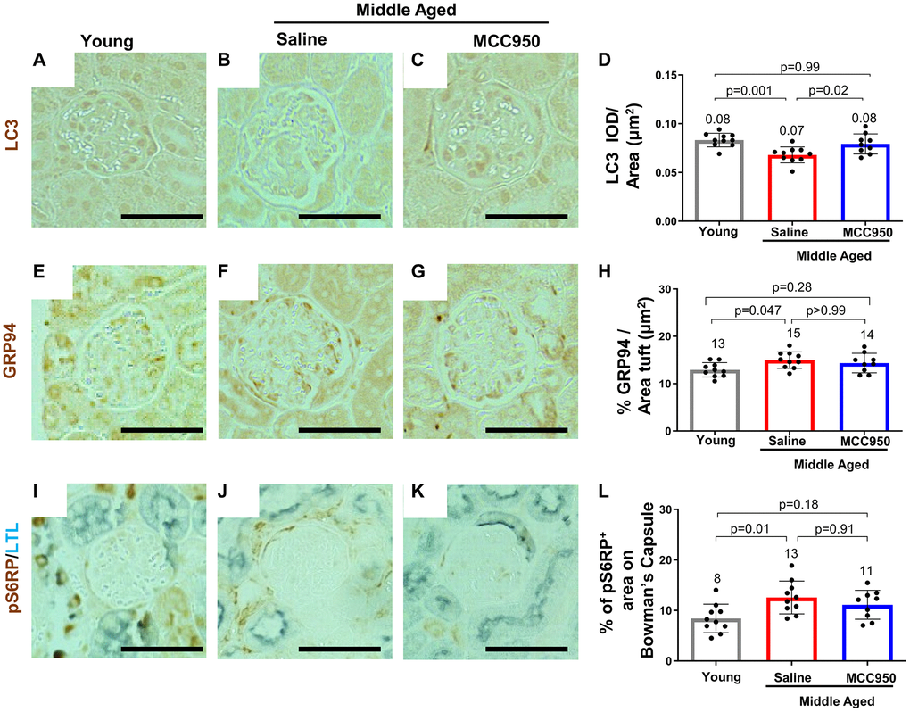 MCC950 treatment improves autophagy signaling. Immunostaining for autophagy marker LC3 (A–D), for the ER stress response protein GRP94 (E–H) and the mTOR signaling readout pS6RP (I–L) comparing young to middle-aged saline- and MCC950-treated mice (I–L). Panels I–K were counterstained with Lotus Tetragonolobus Lectin (LTL, blue) to visualize proximal tubules. Abbreviation: BC: Bowman’s Capsule. Images were quantified and depicted as % tuft area Scale bars in the images correspond to 25 μm.