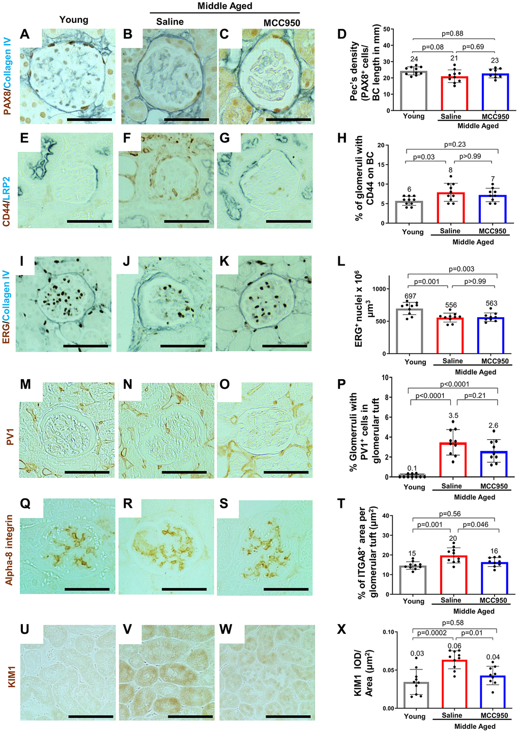 Impact of MCC950 treatment on other glomerular cells and proximal tubules. Immunostainings comparing young to middle-aged saline- and MCC950-treated mice. (A–D) PAX8 (brown, nuclear) and Collagen IV staining (blue) was used to visualize parietal epithelial cells (PECs) and Bowman’s capsule, respectively. Data were quantified and PEC density was calculated by the ratio of PAX8-positive cells and Bowman’s capsule (BC) length (D). (E–H) Immunostaining for CD44 (brown) and LRP2 (blue) was used to label activated PECs and proximal tubules, respectively (E–G). To determine the number of glomeruli with activated PECs, data were quantified based on the presence of CD44 staining in BC (H). (I–L) Endothelial cell number was determined staining with the endothelial cell marker ERG (nuclear brown staining) and the BC marker Collagen IV (blue) (I–K). Data were quantified as number of nuclei per mm2 (L). (M–P) To assess endothelial injury, kidney sections were stained for PV-1 (brown) as a marker of injured endothelial cells (brown) and quantified as percentage of glomeruli with PV-1-positive cells (P). (Q–T) Alpha-8 integrin (ITGA8) staining (brown) was used as a measure of the mesangial area (brown) (Q–S) and quantified as the percent ITGA8-positive area within the glomerular tuft (T). (U–X) To determine the effect of MCC950 on proximal tubules, sections were stained with KIM1 (brown) (U–W) and quantified as IOD per area (X). In all panels representative images are shown and scale bars in the images correspond to 25 μm. In all the graphs, error bars are standard deviation, and the mean levels are stated by the number above the bars.