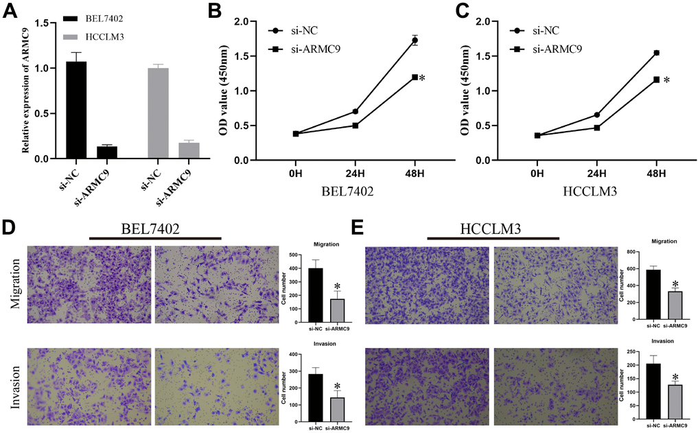 Exploring the oncogenic role of ARMC9 in HCC. (A) Validation of the knockdown efficiency of si-ARMC9 in BEL7402 and HCCLM3. (B, C) The effect of ARMC9 knockdown on the proliferation ability of BEL7402 and HCCLM3 cells was evaluated by CCK8 assay. (D, E) The effect of ARMC9 knockdown on the migration and invasion abilities of BEL7402 and HCCLM3 cells was evaluated by Transwell assay.