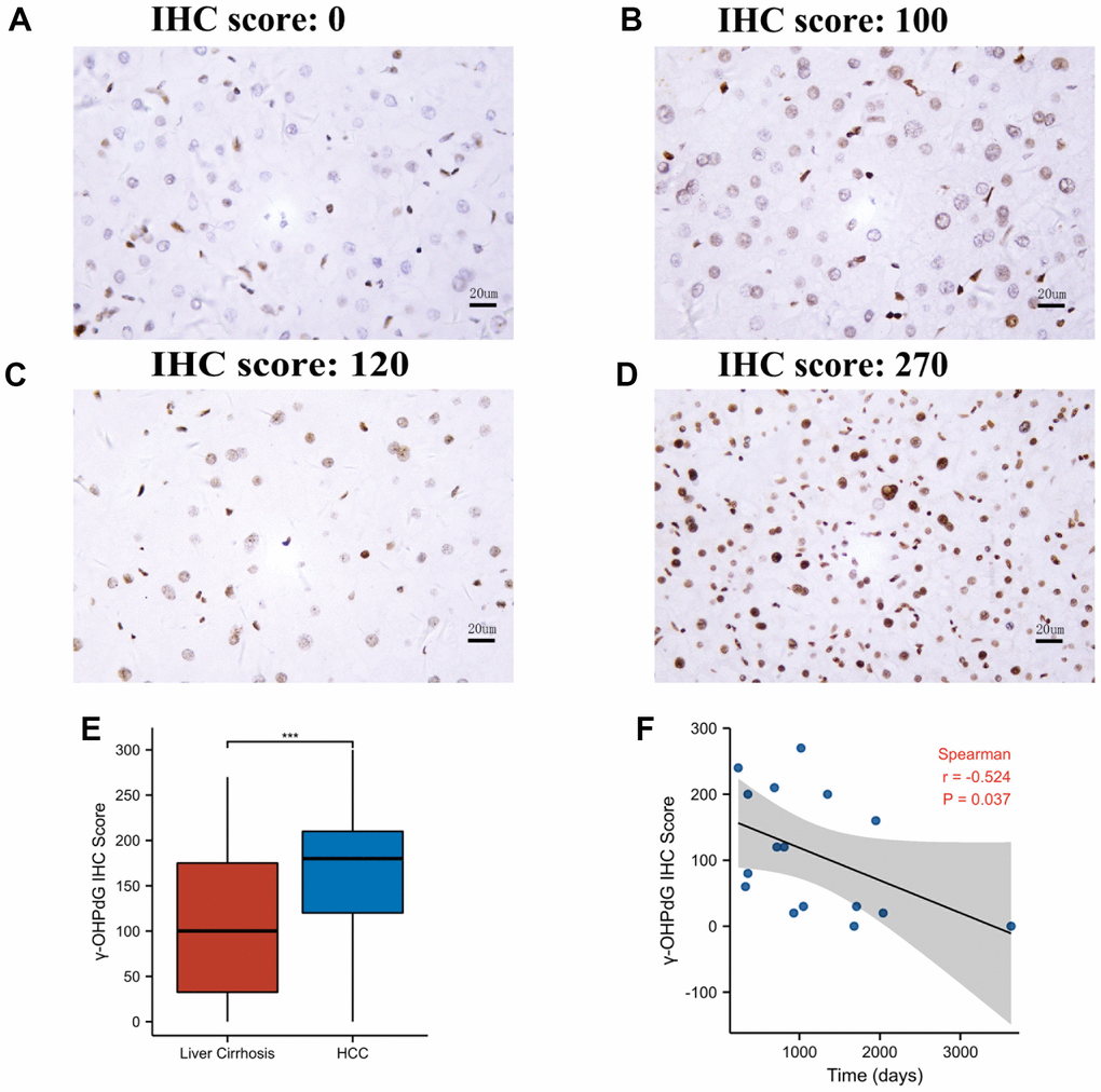 The γ-OHPdG levels in cirrhosis patients. (A, B) The levels of γ-OHPdG (representatives of IHC staining) in cirrhosis tissues. (C, D) γ-OHPdG IHC examination of cirrhosis tissues advanced to HCC; (E) The comparison of γ-OHPdG levels in HCC and the cirrhosis tissues; (F) Dot plotting and Spearman fitting show the correlation between γ-OHPdG levels and the time of cirrhosis advanced to HCC. *** indicates P 