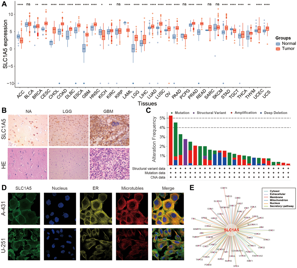 Basic information on SLC1A5 across cancers. (A) Expression levels of SLC1A5 in normal and cancerous tissues. (B) Immunohistochemistry and HE staining of SLC1A5 in normal brain and glioma tissues. (C) Alteration frequency of SLC1A5 across cancers based on the cBioPortal database. (D) Immunofluorescence images of SLC1A5 protein expression in the nucleus, endoplasmic reticulum (ER), and microtubules in A-431 and U-251 cells. (E) The protein‒protein interaction (PPI) network shows the proteins interacting with SLC1A5.