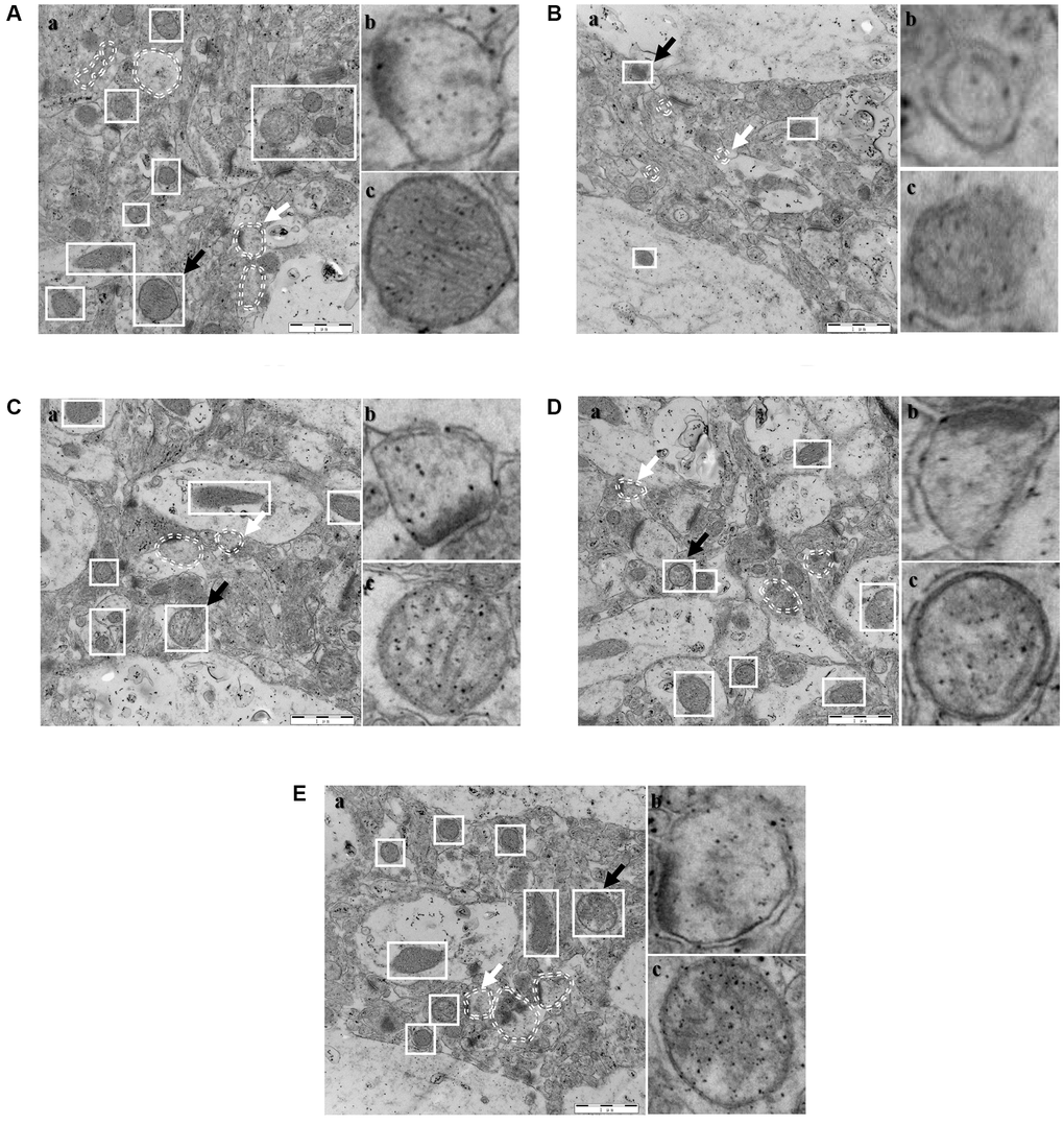 Electron microscope sections of the hippocampi of mice (n = 3). (A) Control; (B) Model; (C) SCPE 2.3 g/kg; (D) SCPE 4.6 g/kg; (E) SCPE 9.2 g/kg. (a) TEM detection; (b) enlarged autophagosomes; (c) enlarged mitochondria. The white elliptical dotted lines and white arrows indicate enlarged autophagosomes. The white solid square lines and black arrows indicate enlarged mitochondria. Bars: 1 μm.