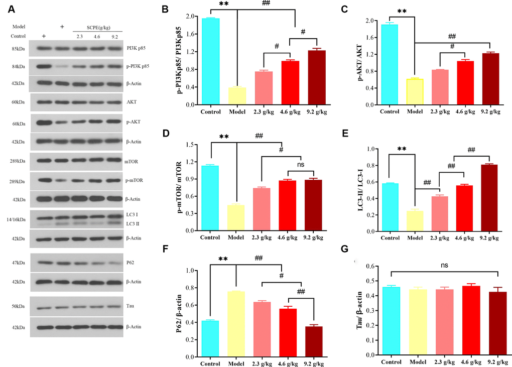 Expression of proteins related to PI3K/AKT/mTOR signaling in the hippocampus. (A) Western blot bands showing the levels of the p-PI3Kp85, PI3Kp85, p-AKT, AKT, p-mTOR, mTOR, LC3-II, LC3-I, P62, and Tau proteins in the hippocampus. (B–G) Quantification of the p-PI3Kp85/PI3Kp85, p-AKT/AKT, p-mTOR/mTOR, LC3-II/LC3-I P62, and Tau levels in the hippocampal tissue. The data are presented as means ± SD (n = 3). **P ##P #P 