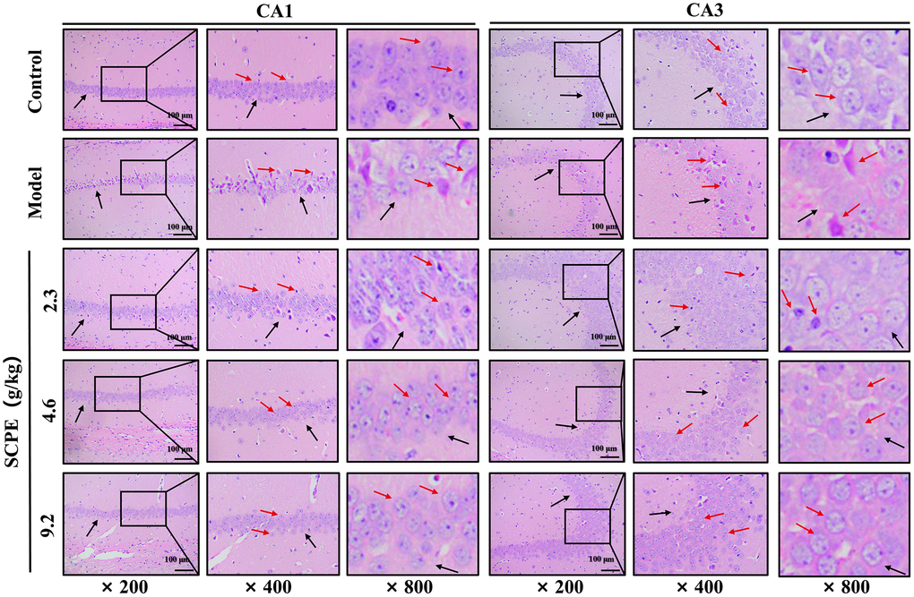 HE staining of the hippocampal CA1 and CA3 regions (n = 3). The black arrows show the arrangement of pyramidal cells and intercellular space. The red arrows show the morphology of the neuron.