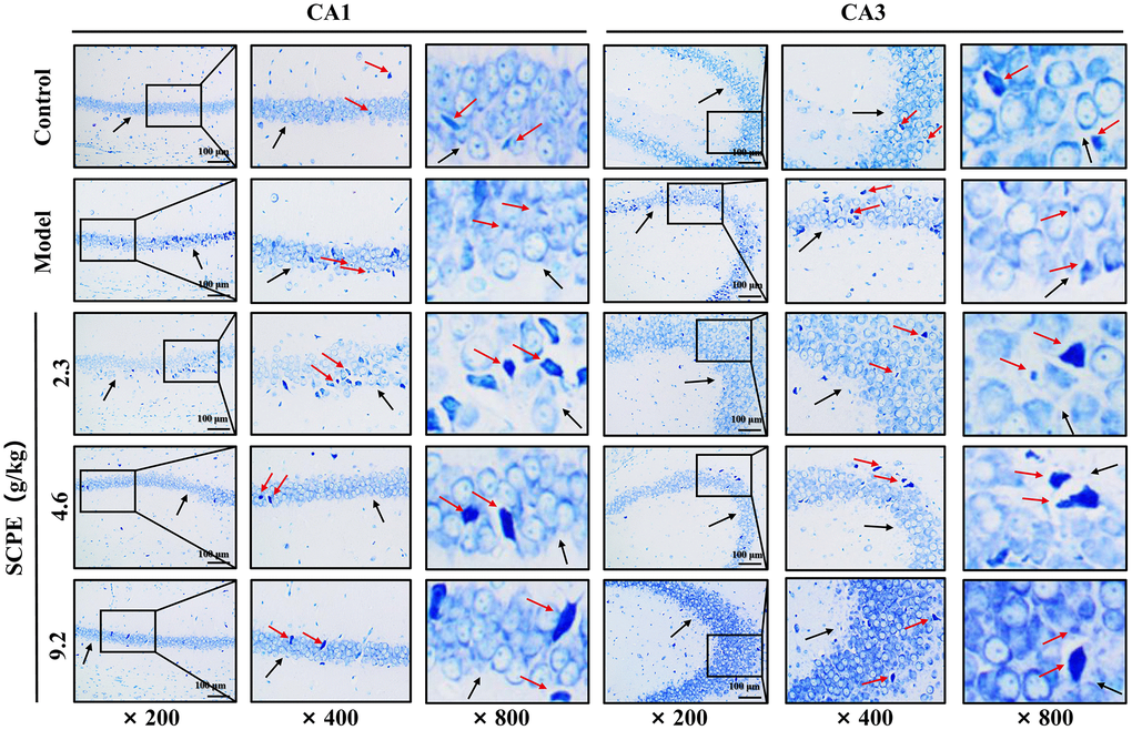 Toluidine blue staining in the hippocampal CA1 and CA3 regions of each group (n = 3). The black arrows indicate the arrangement of pyramidal cells and the basic morphology of neurons in the CA1 and CA3 regions of the hippocampus. The red arrows represent the Nissl body.