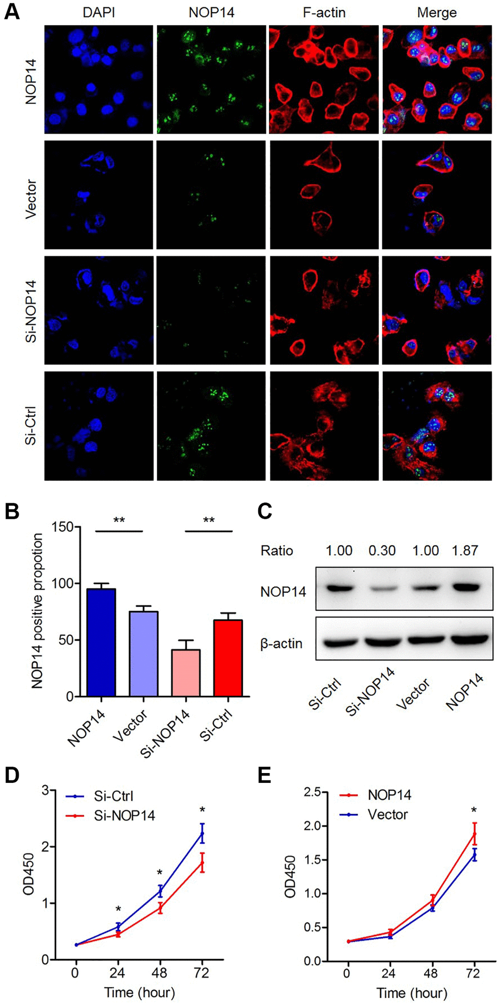 Impacts of dysregulation of NOP14 on pancreatic cancer cell proliferation. (A) Immunofluorescence analysis of NOP14 up- or downregulation in PANC1 pancreatic cancer cells. Magnification 100×. Blue, DAPI-labeled nuclei; green, FITC-conjugated anti-NOP14 antibody; red, phalloidin-labeled cytoskeletal F-actin; merge, superimposition of the above three images. (B) Proportion of NOP14-positive cells after up- or downregulation of NOP14, as assessed by fluorescence microscopy. (C) NOP14 expression level after up- or downregulation in PANC1 cancer cells, as determined by Western blot analysis with standardized relative gray ratio. (D) Effect of NOP14 inhibition on cell proliferation ability. (E) Effect of NOP14 overexpression on cell proliferation ability. *P **P 