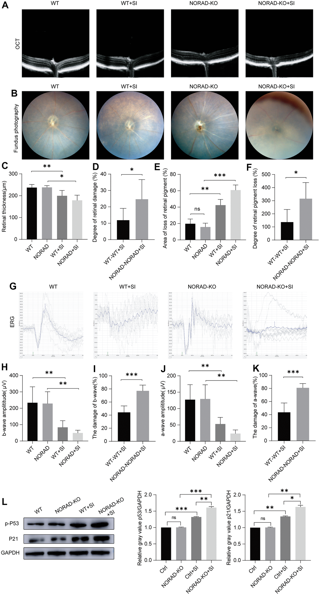 Injury effects of NORAD knockout on the retina of NaIO3-treated mice. Different techniques were used to detect retinal damage in wild-type mice and NORAD knockout mice treated with sodium iodate. (A) Optical coherence tomography (OCT) was performed seven days after NaIO3 treatment for all three study groups. (B) Funduscopic examinations were performed seven days after SI injection. Representative OCT and fundus fluorescence shows the RPE of the mice in each experimental group. (C) Statistical graph of retinal thickness. (D) Statistical graph of retinal damage between WT mouse and NORAD-KO mouse after SI injection. (E) Statistical graph of retinal pigment loss area. (F) Statistical graph of retinal pigment loss degree between WT mouse and NORAD-knockout mouse after SI injection. (G) Electroretinography was performed to investigate the function of the retina in response to light. (H) Statistical graph of b wave amplitude change. (I) Statistical graph of the degree of change in b wave amplitude between WT mouse and NORAD-knockout mouse in eight days after SI injection. (J) Statistical graph of a wave amplitude change. (K) Statistical graph of the degree of change in a wave amplitude between WT mouse and NORAD-knockout mouse in eight days after SI injection. n≥3, *P L) Western blot was used to detect the p-P53 and P21 expression levels. n = 3, *P 