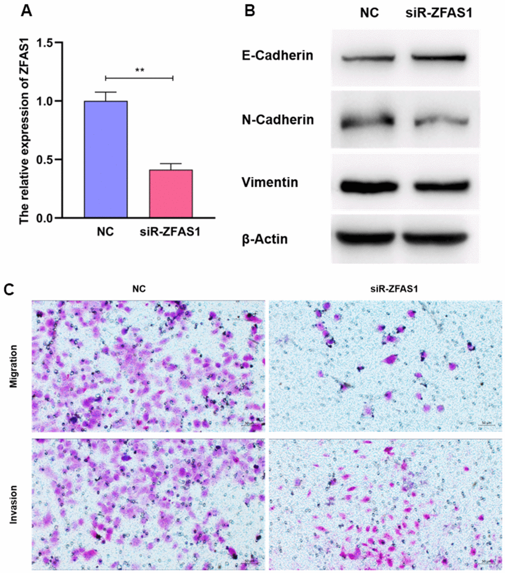 ZFAS1 enhanced the abilities of invasion and migration of A549. The knockdown efficiency of siR-ZFAS1 (A). Compared to the NC group, A549 cells transfected with siR-ZFAS1 showed higher expression of E-Cadherin and lower expression of N-Cadherin and Vimentin (B). SiR-ZFAS1 significantly reduced the ability of invasion and migration in A549 cell line (C).