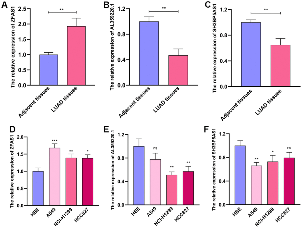 The expression levels of AL359220.1, ZFAS1 and SH3BP5-AS1 in cell lines and LUAD tissues. The qPCR results of the expression levels of ZFAS1, AL359220.1 and SH3BP5-AS1 in LUAD tissues and adjacent tissues (A–C) and LUAD cell lines (A549, HCC827 and NCI-H1299) and human bronchial epithelial cell (HBE). (D–F) ZFAS1 highly expressed in LUAD tissues and LUAD cell lines than adjacent tissues and HBE cell. The expression of AL359220.1 and SH3BP5-AS1 in adjacent tissues and HBE cell were higher than that in LUAD tissues and LUAD cell lines.