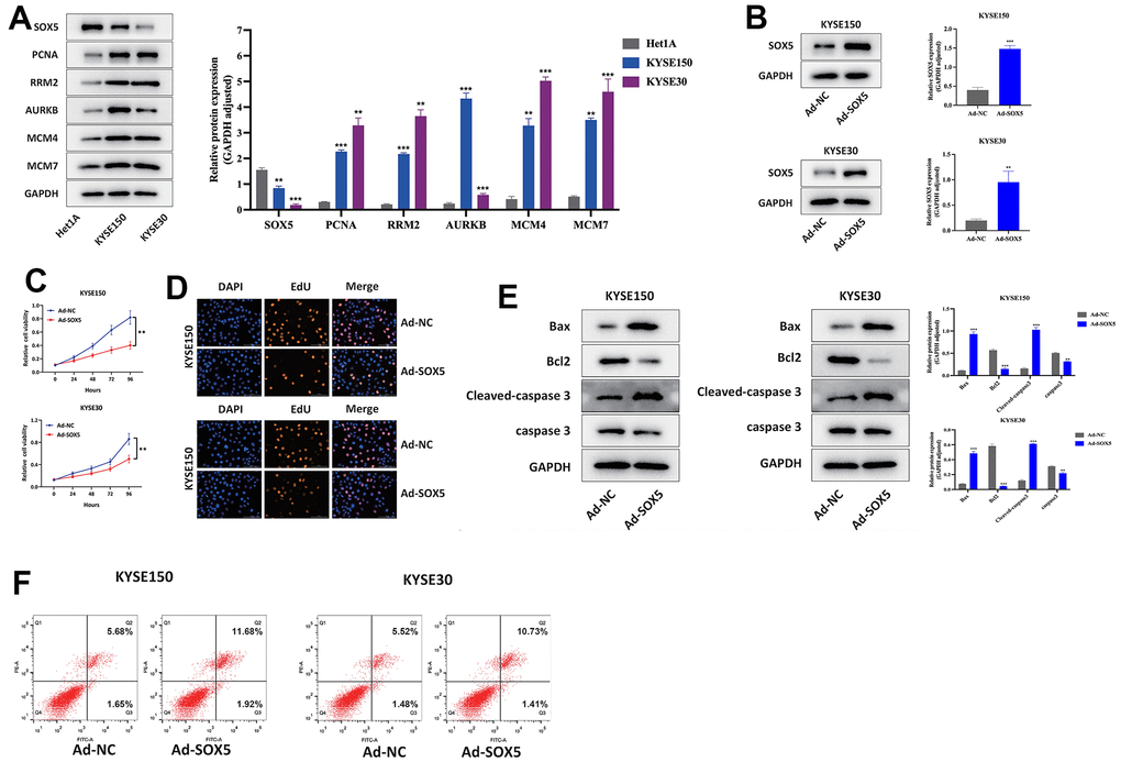 Upregulation of SOX5 inhibited proliferation and increased apoptosis of ESCC cells in vitro. (A) Western blot assay of SOX5 and hub genes expression in ESCC and Het1A cells. (B) Western blot assay of SOX5 protein in control and overexpression ESCC cells. (C, D) CCK-8 assay (C) and EdU assay (D) results of different treated cells. (E) Western blot assay of Bcl2, Bax, cleaved-caspase 3 and caspase 3 protein in different treated cells. (F) Flow cytometry analysis of apoptosis of different treated cells. *P P 