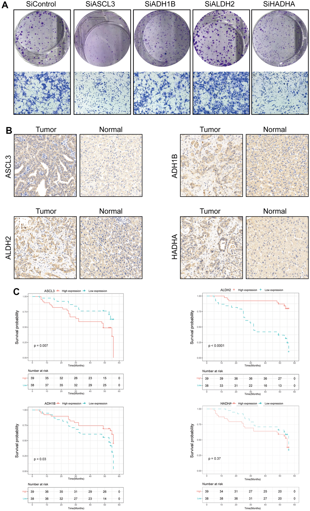 Validation of the four prognostic genes in functional analysis and clinical data. (A) The colony formation and migration analysis of LM3 cell depletion with ACSL3, ADH1B, ALDH2, and HADHA. (B) Immunohistochemistry analysis of ACSL3, ADH1B, ALDH2, and HADHA in HCC tissues. (C) The high expression level of ACSL3 and the low expression level of ALDH2 and HADHA were associated with a poor prognosis. The Cox proportion hazards model was used to understand the significance between the two groups.