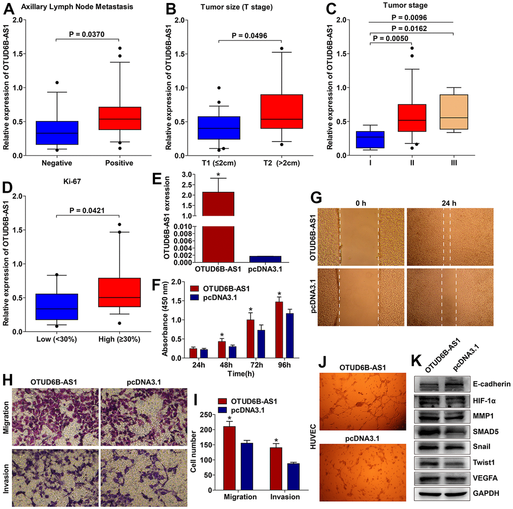 OTUD6B−AS1 was associated with aggressive pathological parameters and promoted breast cancer progression. Expression of OTUD6B−AS1 was positively correlated with axillary lymph node metastasis (A), larger tumor size (B), advanced tumor stage (C, one way ANOVA, P = 0.0096; stage I vs. II, P = 0.0050; stage I vs. III, P = 0.0162; stage II vs. III, not significant), and high Ki-67 expression (D). The OTUD6B−AS1 overexpression plasmid significantly upregulated OTUD6B−AS1 expression in breast cancer BT474 cells (E). OTUD6B−AS1 promoted breast cancer cell proliferation (F), wound healing (G, 40× magnification), migration, and invasion (H, I, 200× magnification). OTUD6B−AS1 increased the tube formation ability of HUVEC (J, 40× magnification). OTUD6B−AS1 decreased E-cadherin expression and increased the expression of HIF-1α, MMP1, SMAD5, Snail, Twist1, and VEGFA (K, cropped gels blots are used).