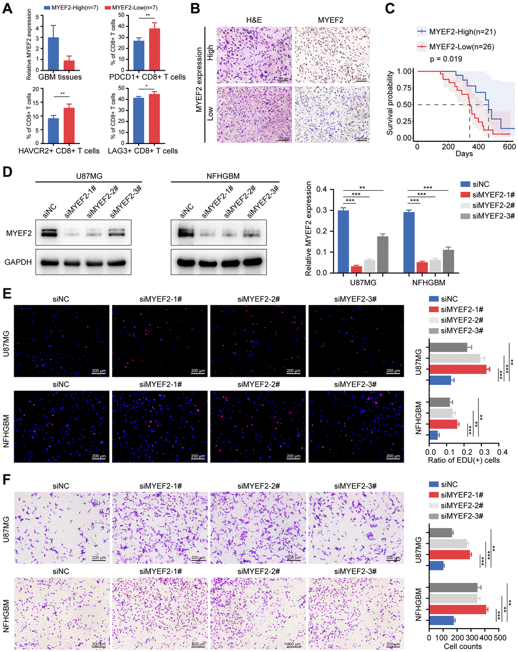 MYEF2 negatively correlates with GBM CD8+ T cells exhaustion and tumor progression. (A) Bar graph of the qRT-PCR of MYEF2 expression in GBM tissues (n = 14) and percent of PDCD1, HAVCR2 and LAG3 expression on CD8+ T cell from MYEF2-High and MYEF2-Low samples as measured by flow cytometry. *P **P ≤ 0.001. (B) Representative images of MYEF2 immunohistochemical staining of GBM tissues. (C) Kaplan–Meier survival curve of NFH-GBM patients stratified by MYEF2 expression (according to IHC data). (D) Western blot assays showing MYEF2 knockdown efficiency in U87MG and NFHGBM cells. (E) EdU assay showing different cell proliferation rates in siMYEF2- and siNC-treated U87MG and NFHGBM cells. Error bars represent the SD of repeats of each cell. **P ***P F) Transwell assay showing cell migration capacity in siMYEF2- and siNC-treated U87MG and NFHGBM cells. Error bars represent the SD of repeats of each cell. **P ***P 