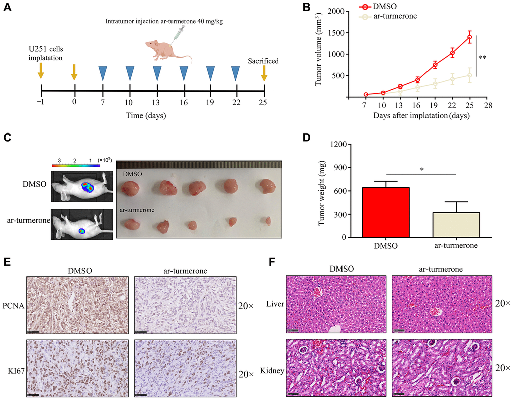 Ar-turmerone repressed the proliferative rate of U251 cells in vivo. (A) Model of the animal experiments. (B, C) The proliferation of tumor tissues from mice treated with DMSO or ar-turmerone. (D) The tumor weights of mice treated with DMSO or ar-turmerone. (E) PCNA and KI67 expression in tumor tissues from mice treated with DMSO or ar-turmerone. (F) Hematoxylin and eosin staining was performed to detect liver and kidney injuries in mice treated with DMSO or ar-turmerone. *P **P 