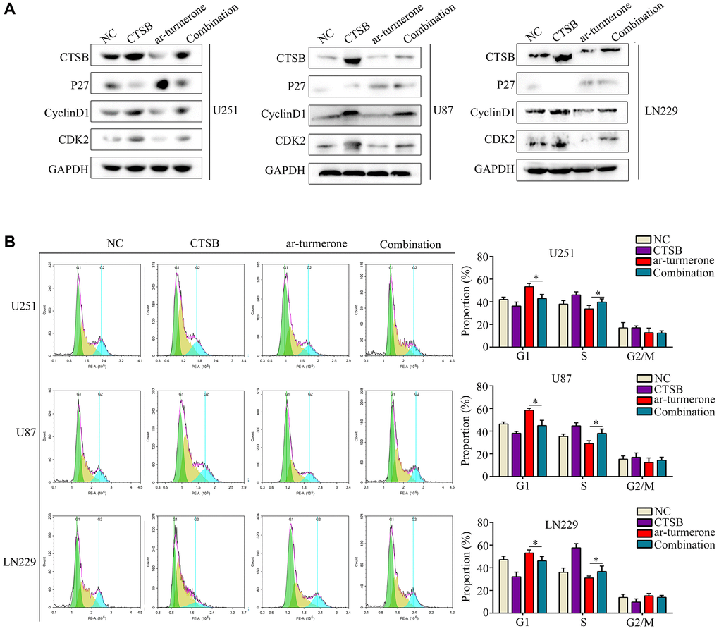 Overexpressing CTSB prevented G1/S−phase cell cycle arrest in ar-turmerone−treated glioma cells. Glioma cells were treated with DMSO, ar-turmerone, CTSB plasmids or ar-turmerone + CTSB plasmids, respectively. (A) Western blotting was used to detect the expression of CTSB, P27, CDK2 and CyclinD1 in each group of cells. (B) Flow cytometry was performed to detect the cell cycle distribution of glioma cells in each group. *P 