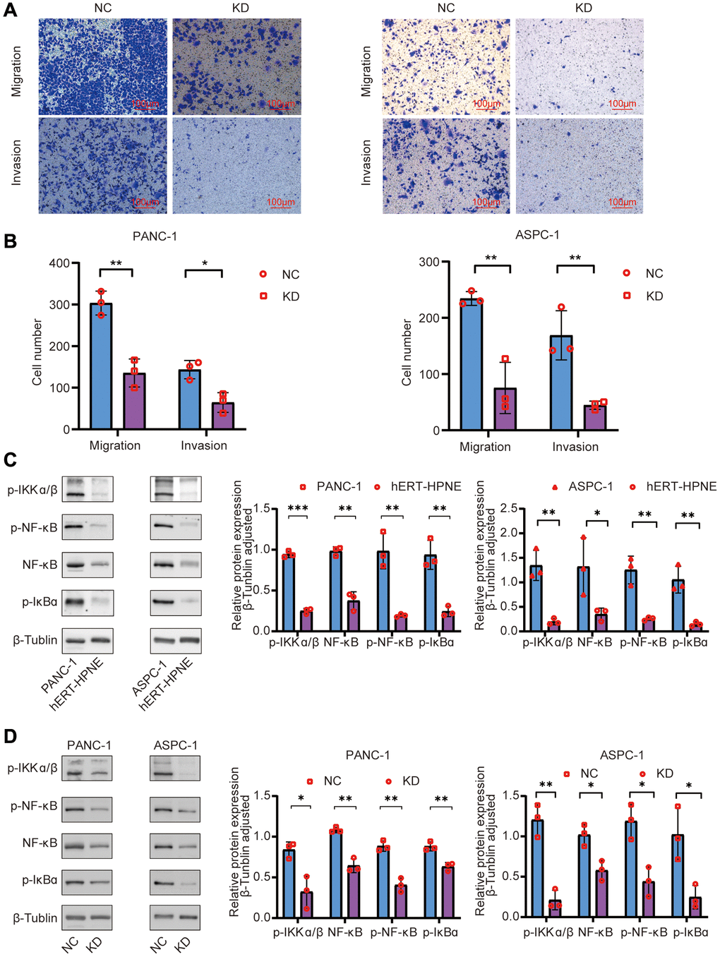 (A, B) Effects of TNFR2 knockdown on migratory and invasive capacities using Transwell assays in PANC-1 and ASPC-1 cells. (C) Western blotting determined that NF-κB signaling-related proteins were overexpressed in the PANC-1 and ASPC-1 cells. (D) Western blotting determined that NF-κB signaling-related proteins were downregulated after TNFR silencing in PANC-1 and ASPC-1 cells.