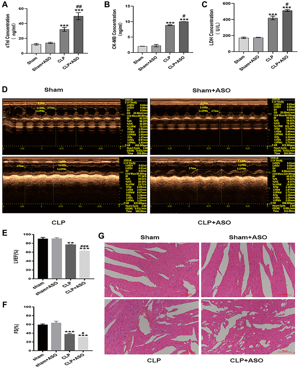 Inhibition of hmgcs2 aggravates myocardial injury in CLP mice. (A–C) Protein contents of cTnI, CK-MB, and LDH in the serum from mice in each group. (D) Echocardiography of mice in each group. (E, F) Echocardiographic statistical analysis of left ventricular ejection fraction (LVEF) and systolic fraction (FS). (G) H&E staining of mice heart tissues in each group (magnification 400×). Sham: sham group (n = 6); Sham + ASO: sham surgery plus ASO administration group (n = 6); CLP: septic myocarditis model group in CLP operated mice (n = 6); CLP + ASO: CLP plus ASO administration group (n = 6). *P **P ***P #P ##P ###P 