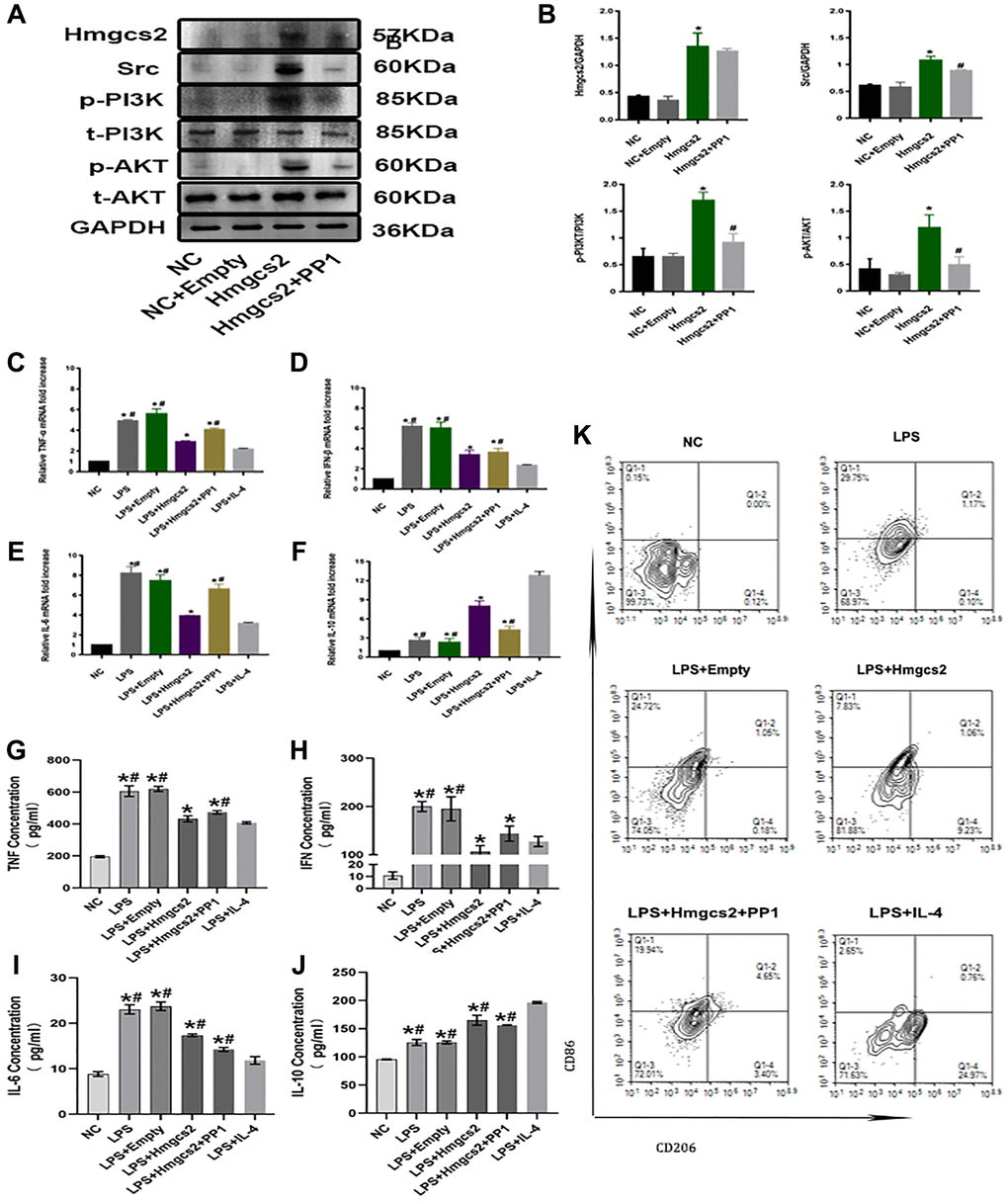 Hmgcs2 promotes macrophage M2 polarization by activating Src/PI3K/AKT pathway. (A) Relative expression of Hmgcs2 and Src/PI3K/AKT pathway-related proteins in cells from each group. (B) Statistical results of relative expression of Hmgcs2 and Src/PI3K/Akt pathway-related proteins of cells in each group. (C) The mRNA relative expression of TNF-α of macrophages in each group. (D) The mRNA relative expression of IFN-β of macrophages in each group. (E) The mRNA relative expression of IL-6 of macrophages in each group. (F) The mRNA relative expression of IL-10 of macrophages in each group. (G) Concentrations of TNF-α for macrophages in each group (pg/ml). (H) The concentration of IFN-β in the macrophages of each group (pg/ml). (I) The concentration of IL-6 in macrophages from each group (pg/ml). (J) The concentration of IL-10 in macrophages from each group (pg/ml). (K) The flow cytometry of the macrophage polarization in distinct groups. Abbreviations: NC: control group; LPS: LPS induced M1 type macrophages; LPS+ empty: M1 macrophage group transfected with empty plasmid; LPS+Hmgcs2: Hmgcs2 over-expressing M1 macrophage group; LPS+Hmgcs2+PP1: M1 macrophages with over-expression of Hmgcs2 based on PP1 administration; LPS+IL-4: LPS+IL-4 induced M2 type macrophages. *P **P ***P #P ##P ###P 