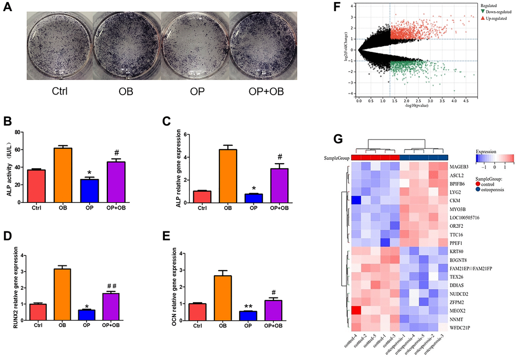 The difference of MSCs between osteoporosis and control. (A) ALP staining of osteogenic differentiation of MSCs from osteoporosis mice and control mice. (B) Quantitative analysis of ALP activity. (C–E) The gene expression of ALP, RUNX2 and OCN was detected by qRT-PCR after MSCs induced osteogenesis. (F) Volcanic map shows DEGs of MSCs in patients with osteoporosis and control. (G) Heat map shows the top twenty up-regulated and down-regulated DEGs. (Compared with Ctrl group, the statistically significant difference was *p **p #p ##p n = 3).