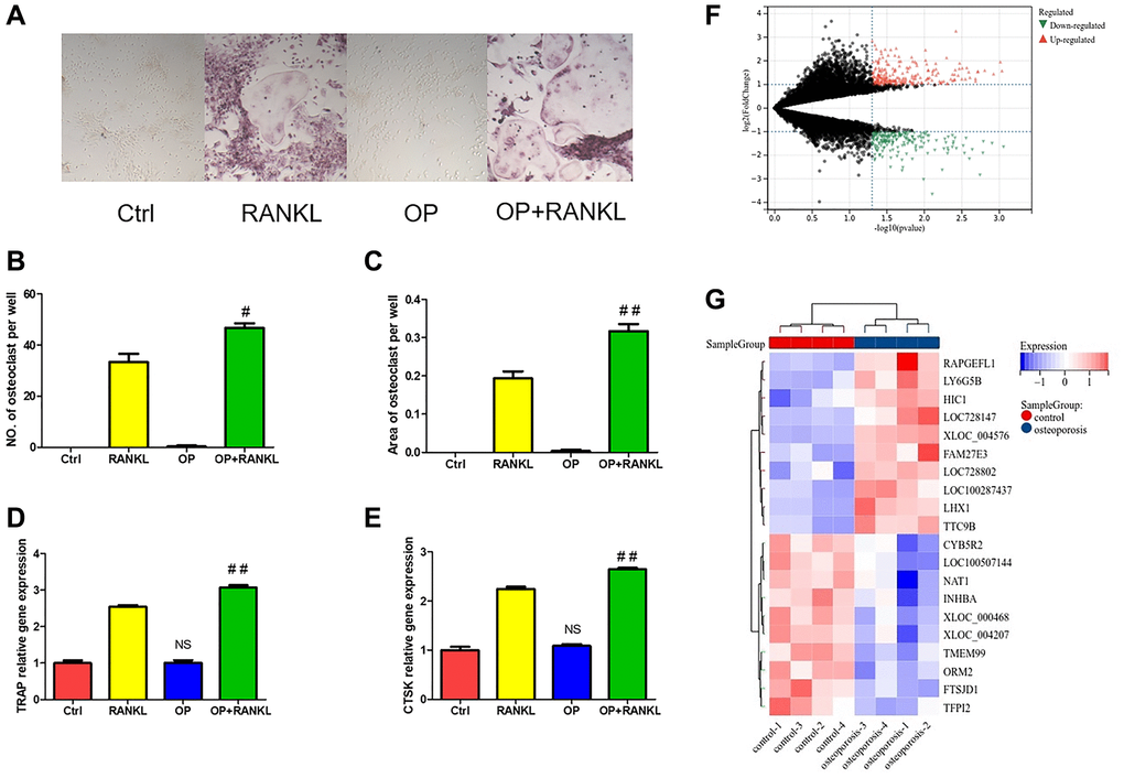 The difference of monocytes between osteoporosis and control. (A) TRAP staining of osteoclast differentiation of monocytes from osteoporosis mice and control mice. (B, C) Quantitative analysis of TRAP positive osteoclasts. (D, E) The gene expression of TRAP and CTSK was detected by qRT-PCR after monocytes induced osteoclast. (F) Volcanic map shows DEGs of monocytes in patients with osteoporosis and control. (G) Heat map shows the top twenty up-regulated and down-regulated DEGs. (NS means no significance compared with the Ctrl group, and compared with RANKL group, the statistically significant difference was #p ##p n = 3).