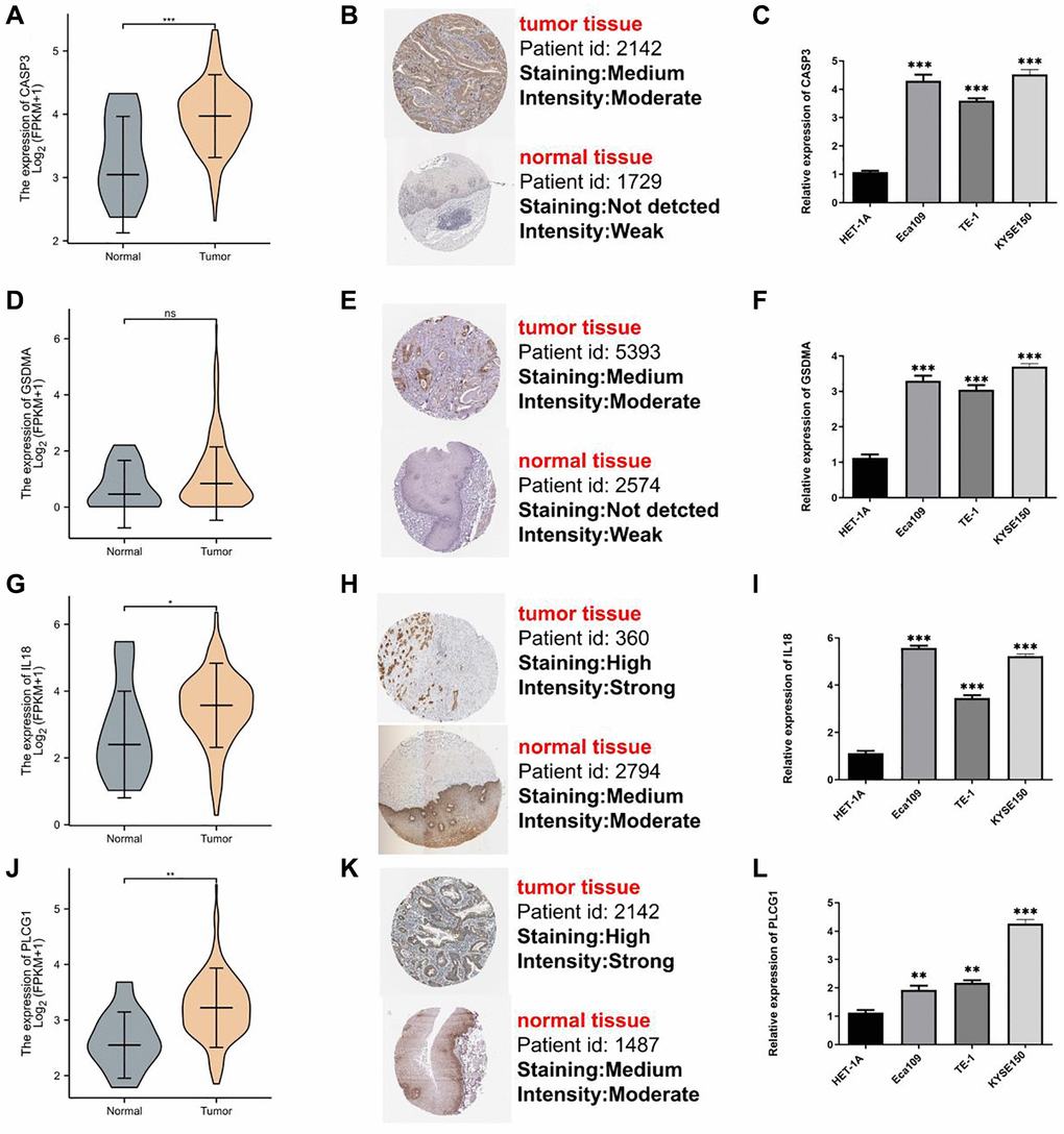 Assays validation for genes participating in model. mRNA expression, IHC, and qRT-PCR for CASP3 (A–C), GSDMA (D–F), IL18 (G–I), and PLCG1 (J–L). *P **P ***P 