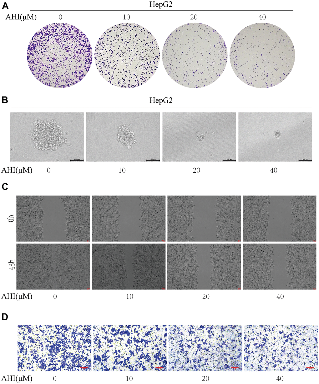 AHI has potential anti-liver cancer properties. (A) Colony formation of HepG2 after treatment with different concentrations of AHI. (B) Sphere formation of HepG2 after treatment with different concentrations of AHI. (C) Effects of AHI on the migration of HCC cell. (D) Effects of AHI on the invasion of HCC cell.