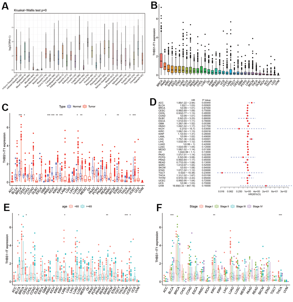 Pan-cancer analysis of THBS1-IT1. (A) Distribution of THBS1-IT1 expression in normal tissues; (B) THBS1-IT1 expression in 33 cancers; (C) Comparisons of THBS1-IT1 expression between tumor and normal samples suggested it was dysregulated in 12 cancer types; (D) The association between THBS1-IT1 expression and OS in 33 types of tumors by forest plot; (E) Correlation between THBS1-IT1 gene expression and age; (F) The relevance of tumor stage and THBS1-IT1 expression. *P 