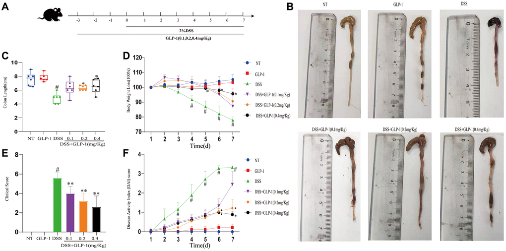 ulcerative colitis glp 1 The alleviating effect and mechanism of GLP-1 on ulcerative colitis