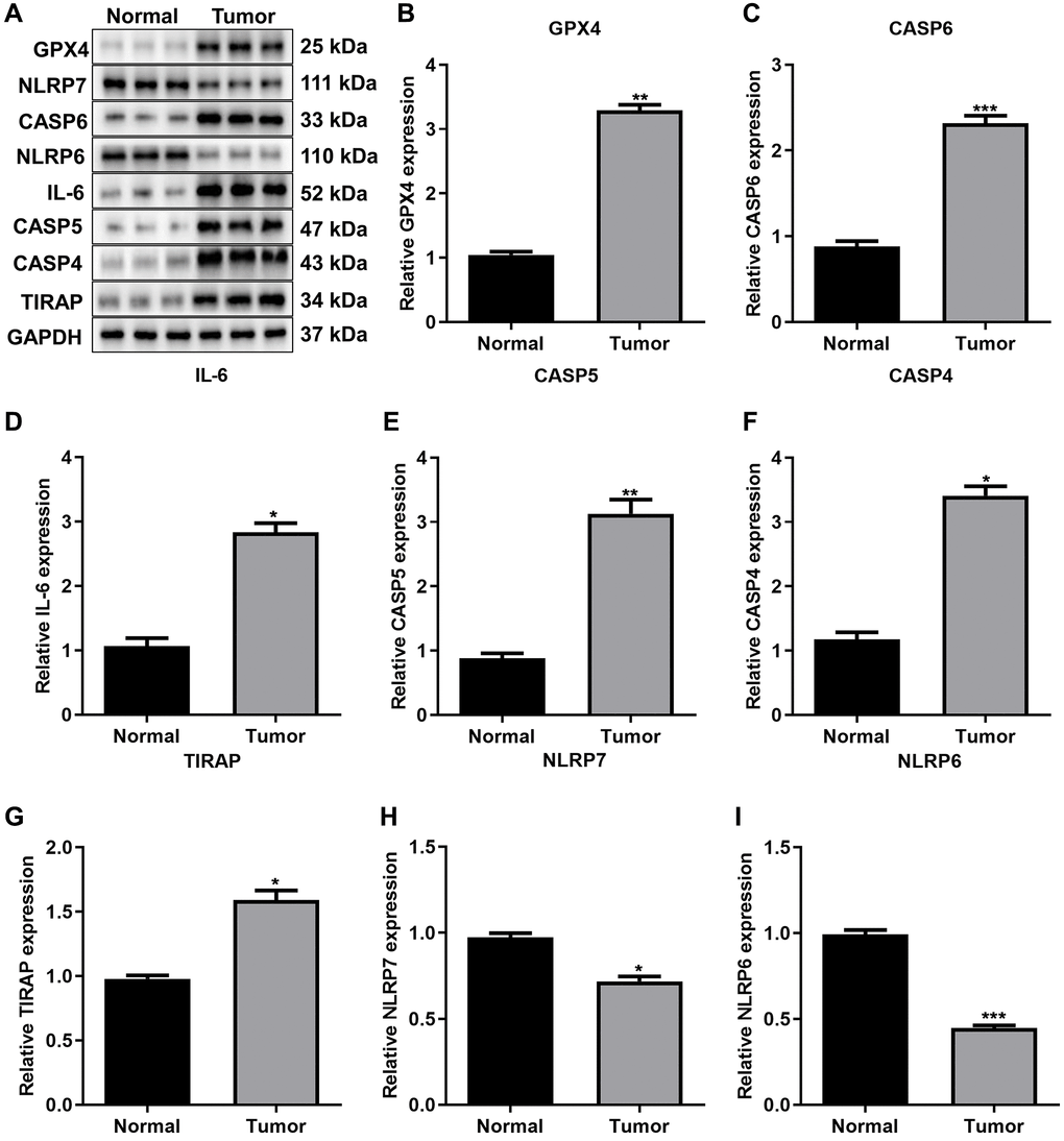 Validation of the expression of prognostic pyroptosis-related genes. (A–I) Western blot for the expression of (B) GPX4, (C) CASP6, (D) IL-6, (E) CASP5, (F) CASP4, (G) TIRAP, (H) NLRP7 and (I) NLRP6 in three paired gastric cancer tissues and normal tissues. The asterisks indicated the statistical p-values (*p **p ***p 