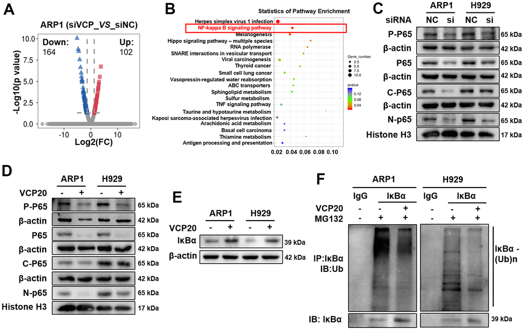 VCP regulates MM cell proliferation via modulating NF-κB signaling pathway. (A) Volcano plots showed the upregulated (red) and downregulated (blue) genes upon silencing VCP in MM cells. (B) KEGG pathway analysis of RNA-seq data indicated that VCP was associated with NF-κB signaling pathway. (C) WB analysis of P-P65 and P65 expressions in siVCP cells compared with NC cells. (D) WB analysis of P-P65 and P65 expressions in the cells treated with VCP20 compared with WT cells. (E) VCP20 increased IκBα expression. (F) The ubiquitination level of IKBα in MM cells with the treatment of VCP20 or not.