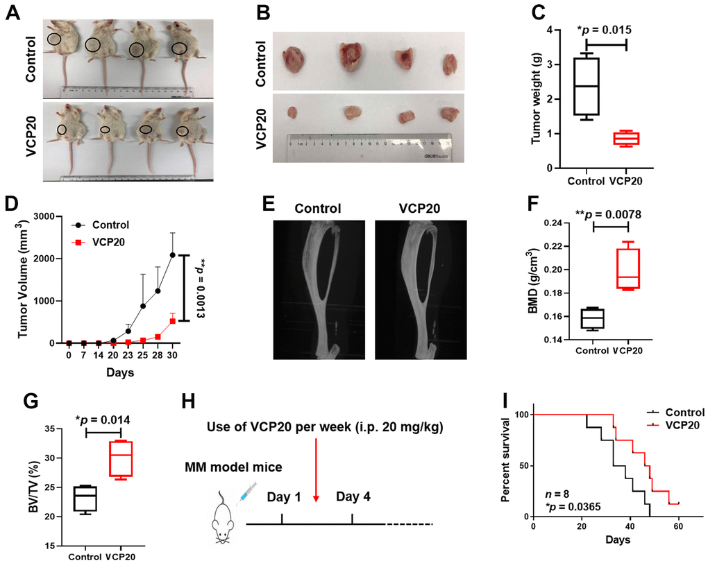 VCP20 impedes MM cell proliferation and prolongs MM mice survival in vivo. (A) Photographic images of xenograft mice at Day 31 (n = 4, VCP20: i.p. 20 mg/kg, twice a week). (B) Images of the harvested xenograft tumors. (C) Mean tumor weight of NOD/SCID mice. (D) Time course of tumor growth. V = 0.52 × larger diameter × (smaller diameter)2. (E) Representative micro-CT images of the bones. (F) BMD of 5TMM3VT mice in Control and VCP20 groups. (G) BV/TV of 5TMM3VT mice in Control and VCP20 groups. (H) VCP20 treatment started from the day after injection (VCP20: i.p. 20 mg/kg, twice a week) and continued until the mice were dead. (I) VCP20 extended the survival period of MM mice (n = 8). Data are presented as the mean ± SD; *p p 